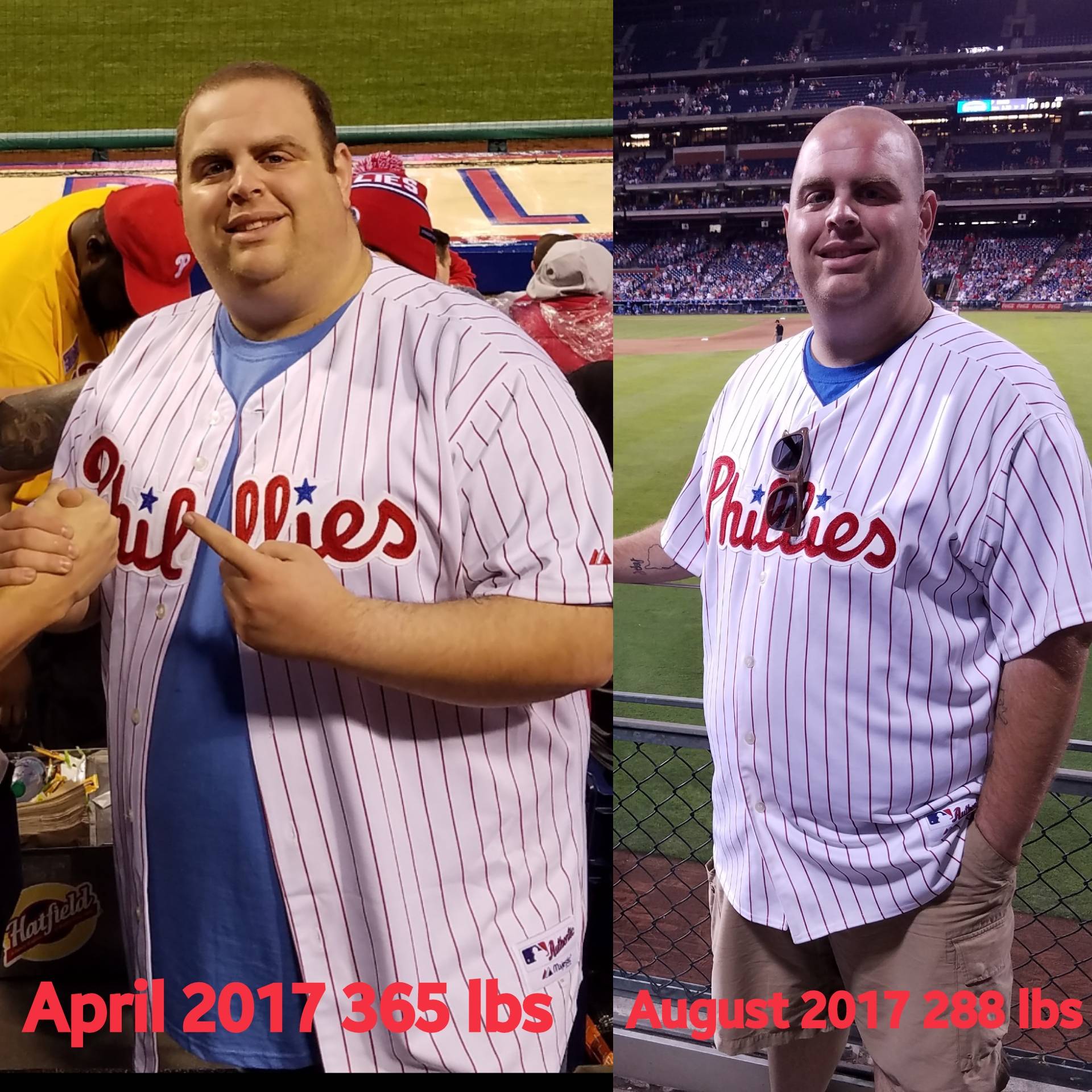 Gastric sleeve, 10 weeks post op!! Scrolller