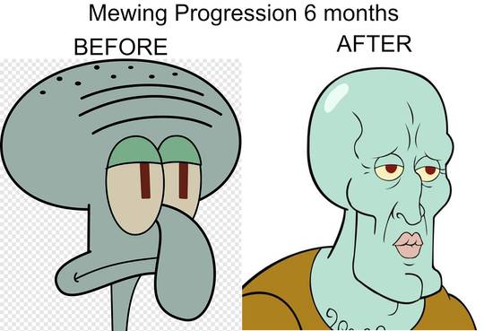 Undeniable proof that mewing works! Before/After of me sometime in 2018 vs.  me now! : r/orthotropics