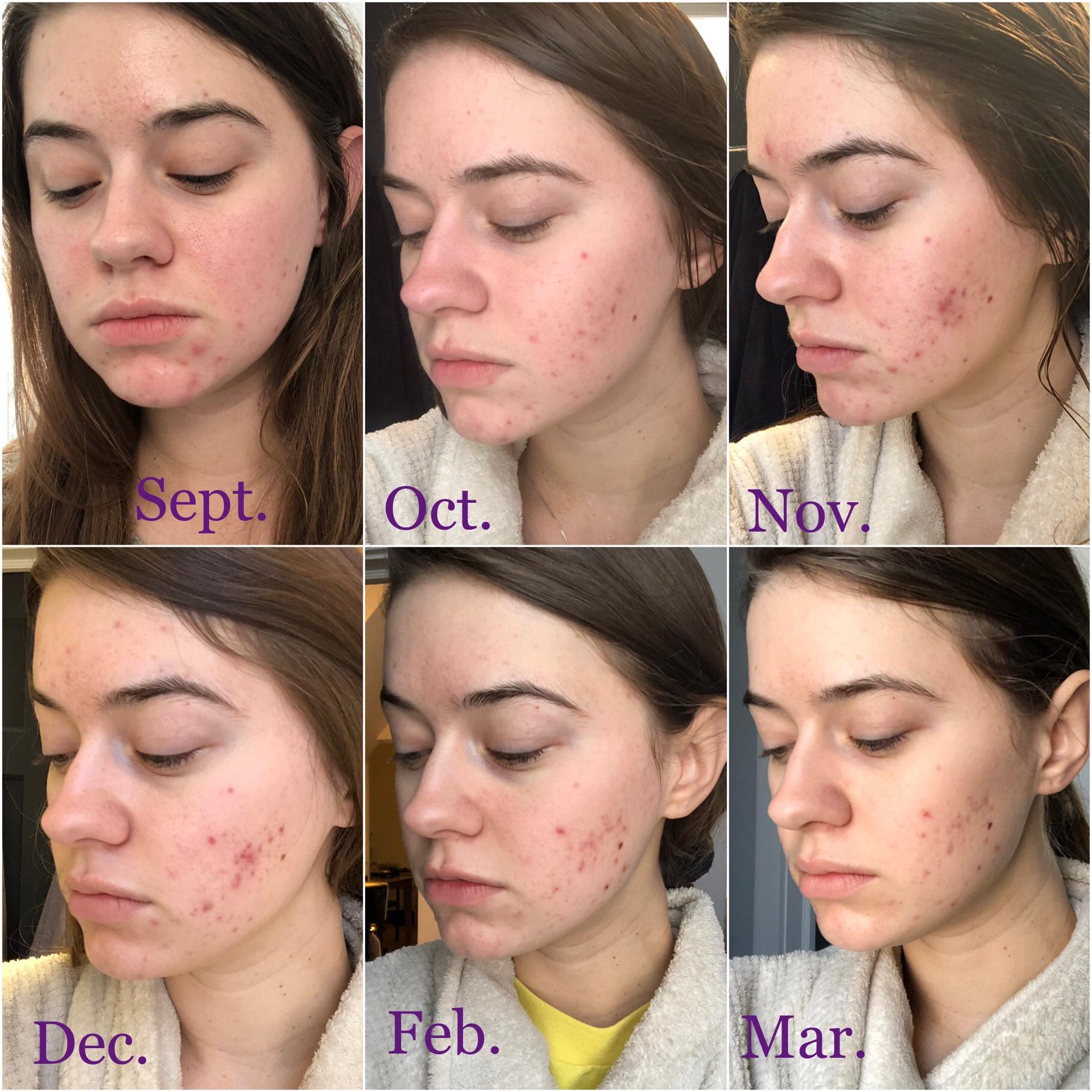 I’m starting to see some progress! | Scrolller