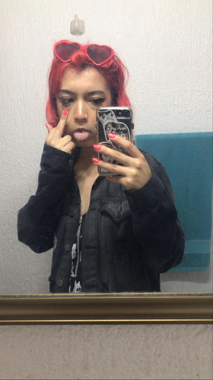 i-ve-had-a-week-long-migraine-and-pain-killers-aren-t-working-please