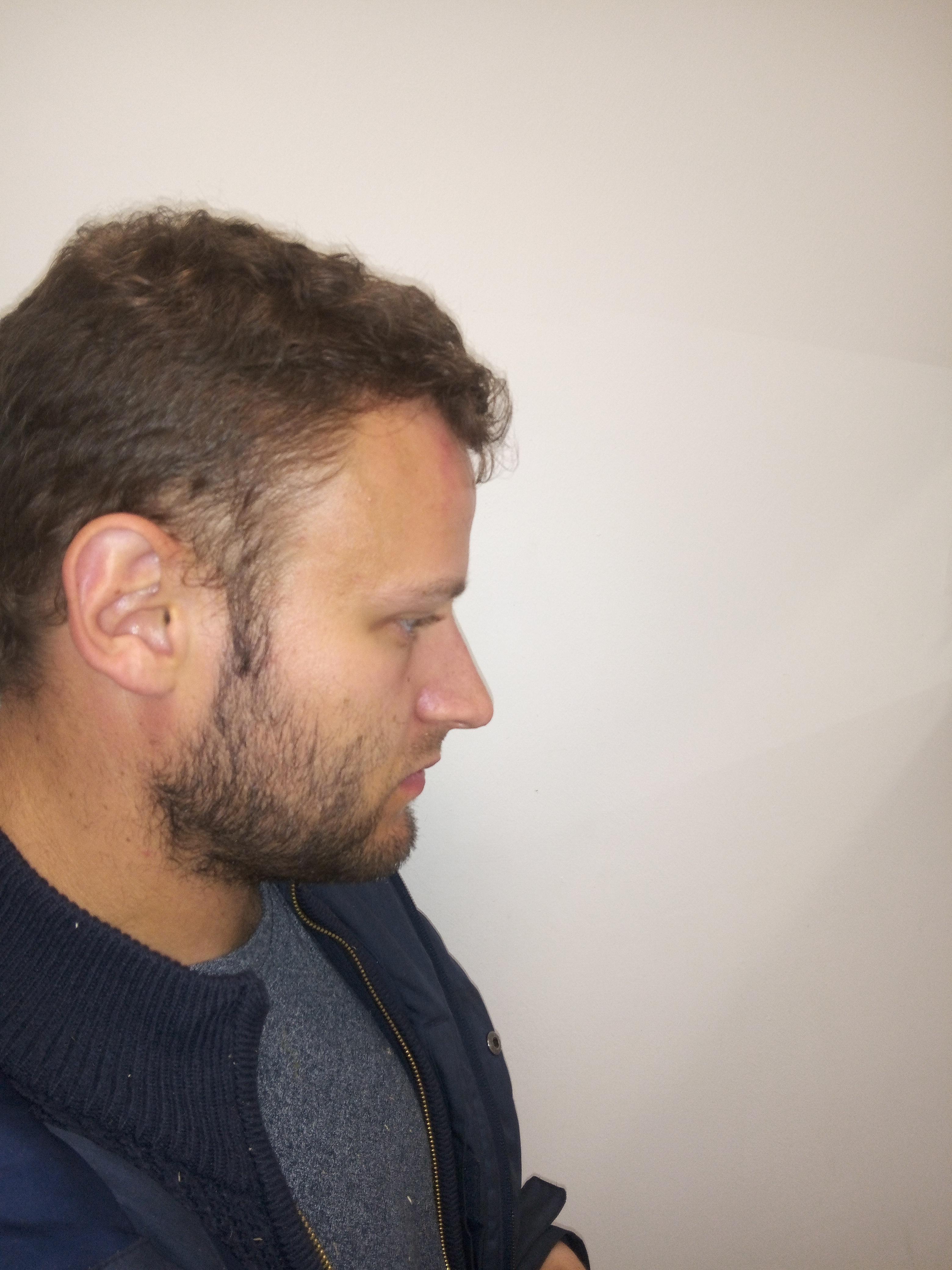 The Hidden Secrets of the Most Captivating Greek Nose Forever