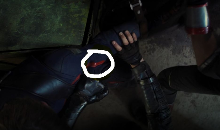 Is This A Broken Bone Scrolller