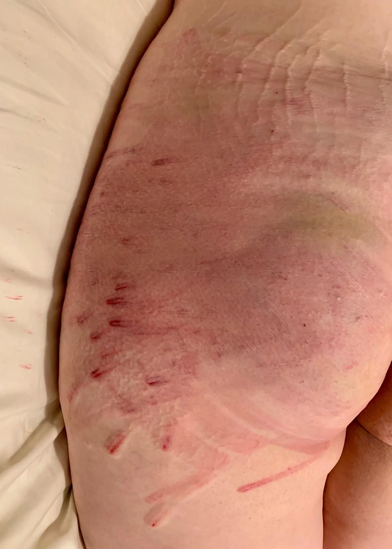 Pretty marks from my owner ♥️