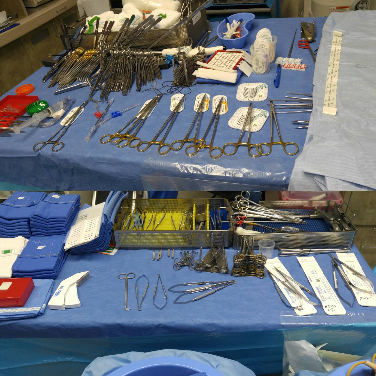 My CABG set up. | Scrolller