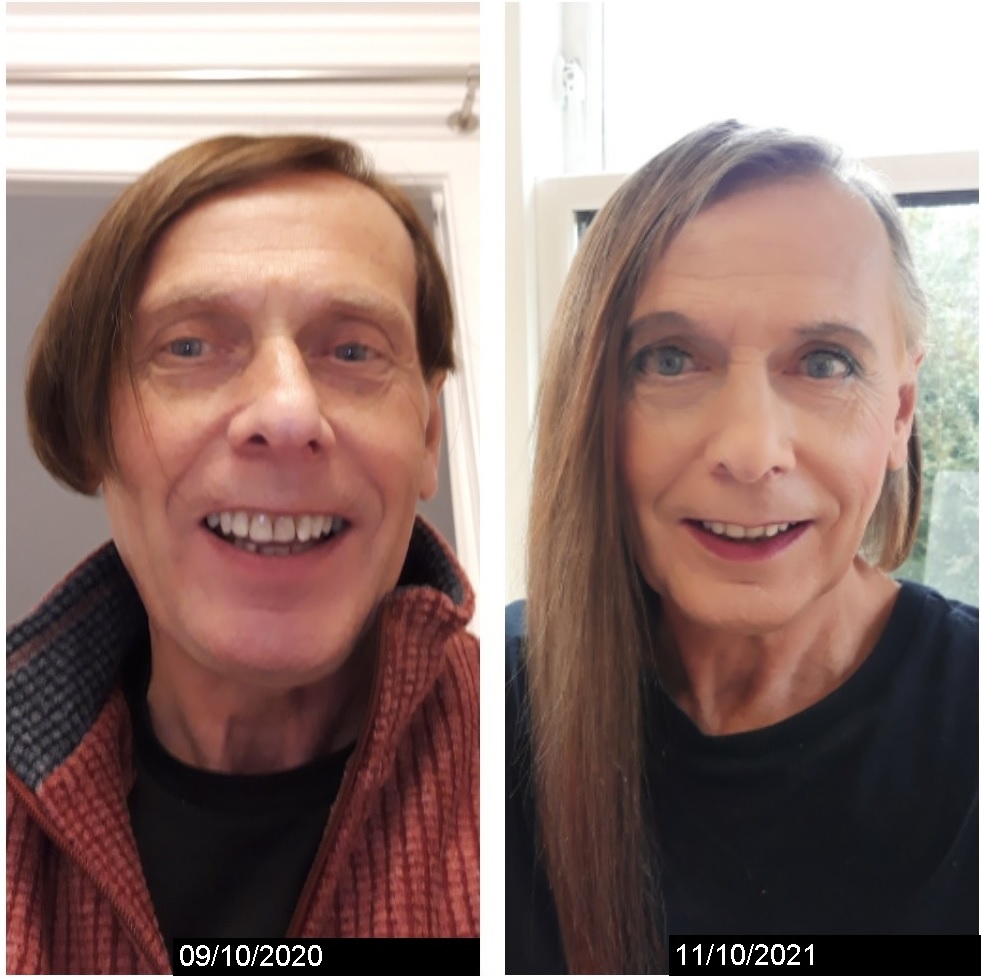 My first timeline picture. Nine months v 21 months low dose HRT Scrolller