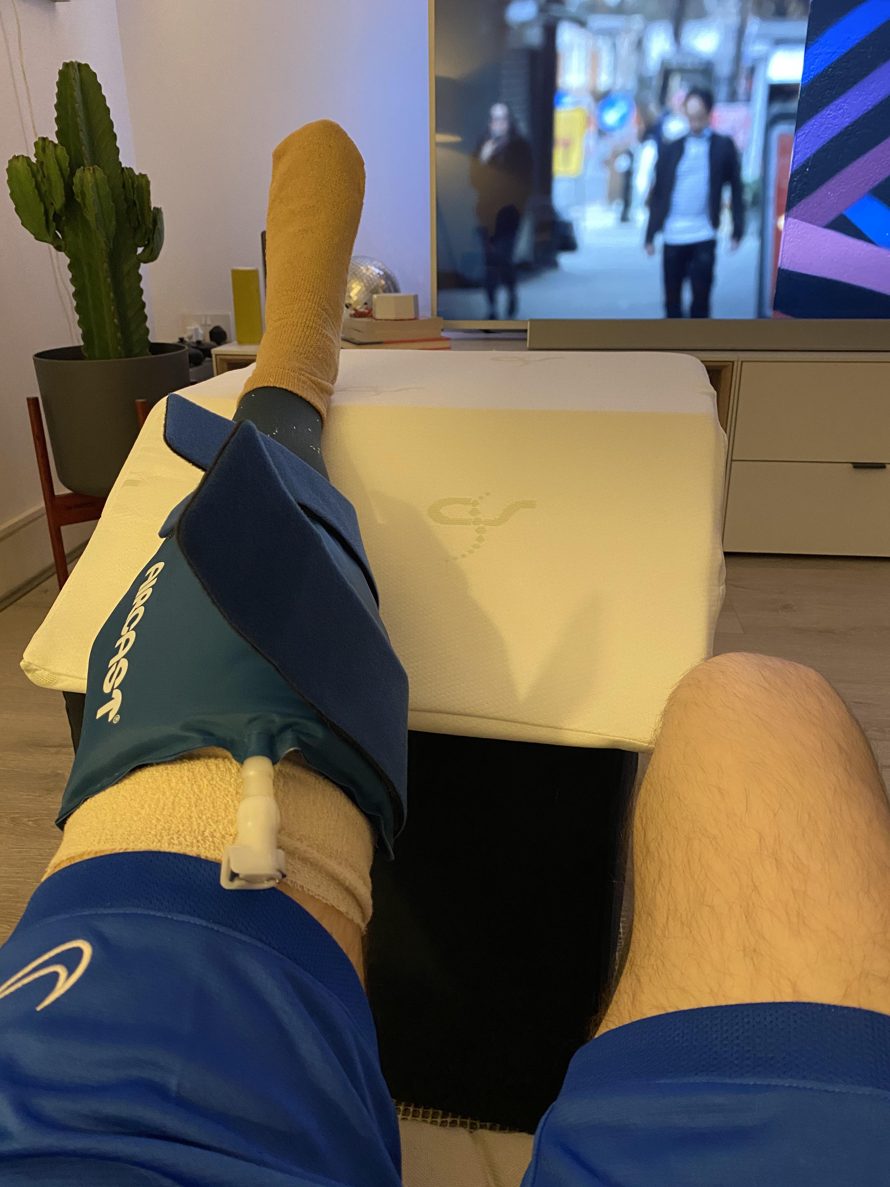 Nearly 12 hours after ACL reconstruction and partial meniscectomy! 4