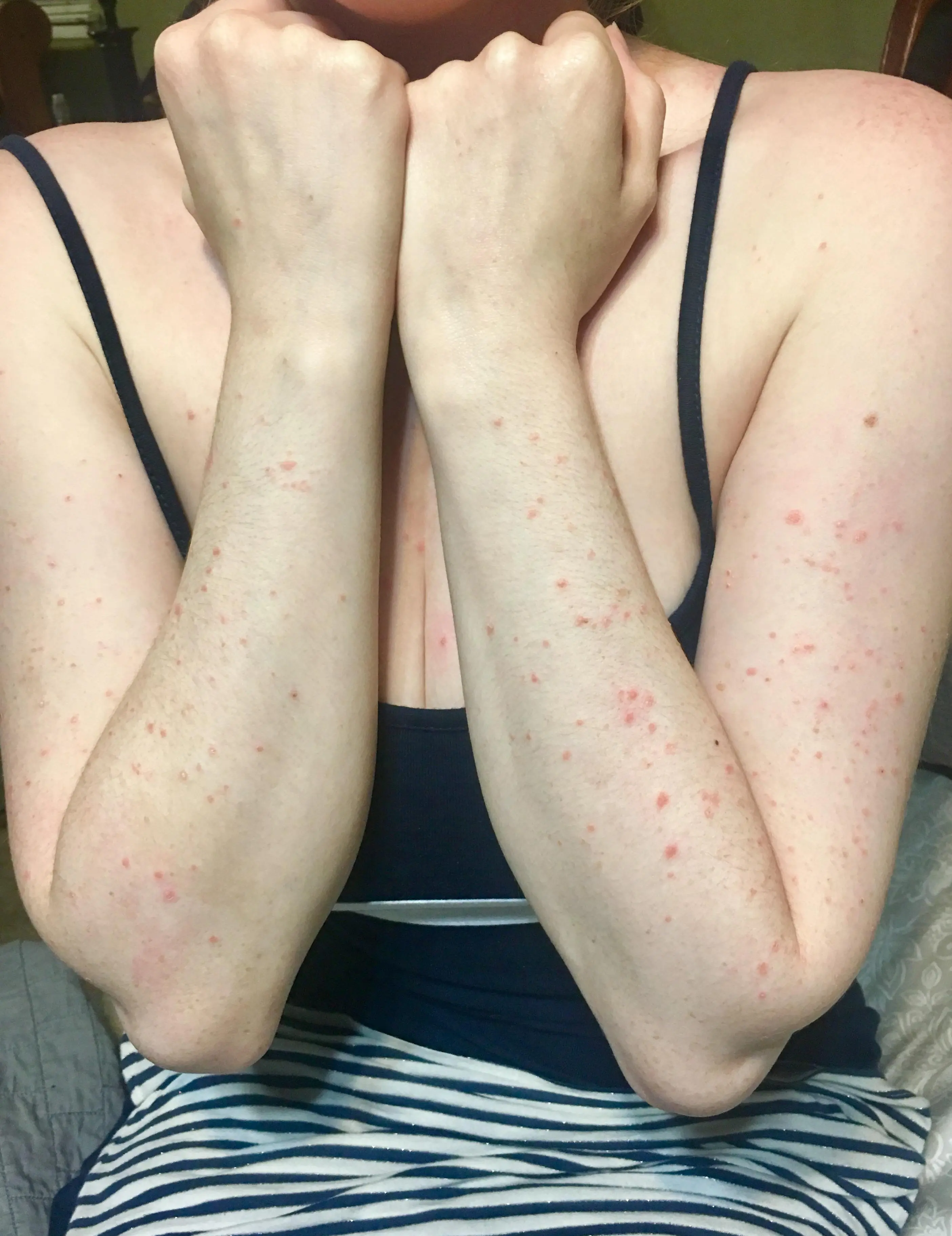 Please help identify this rash that appears when ill with cold or flu ...