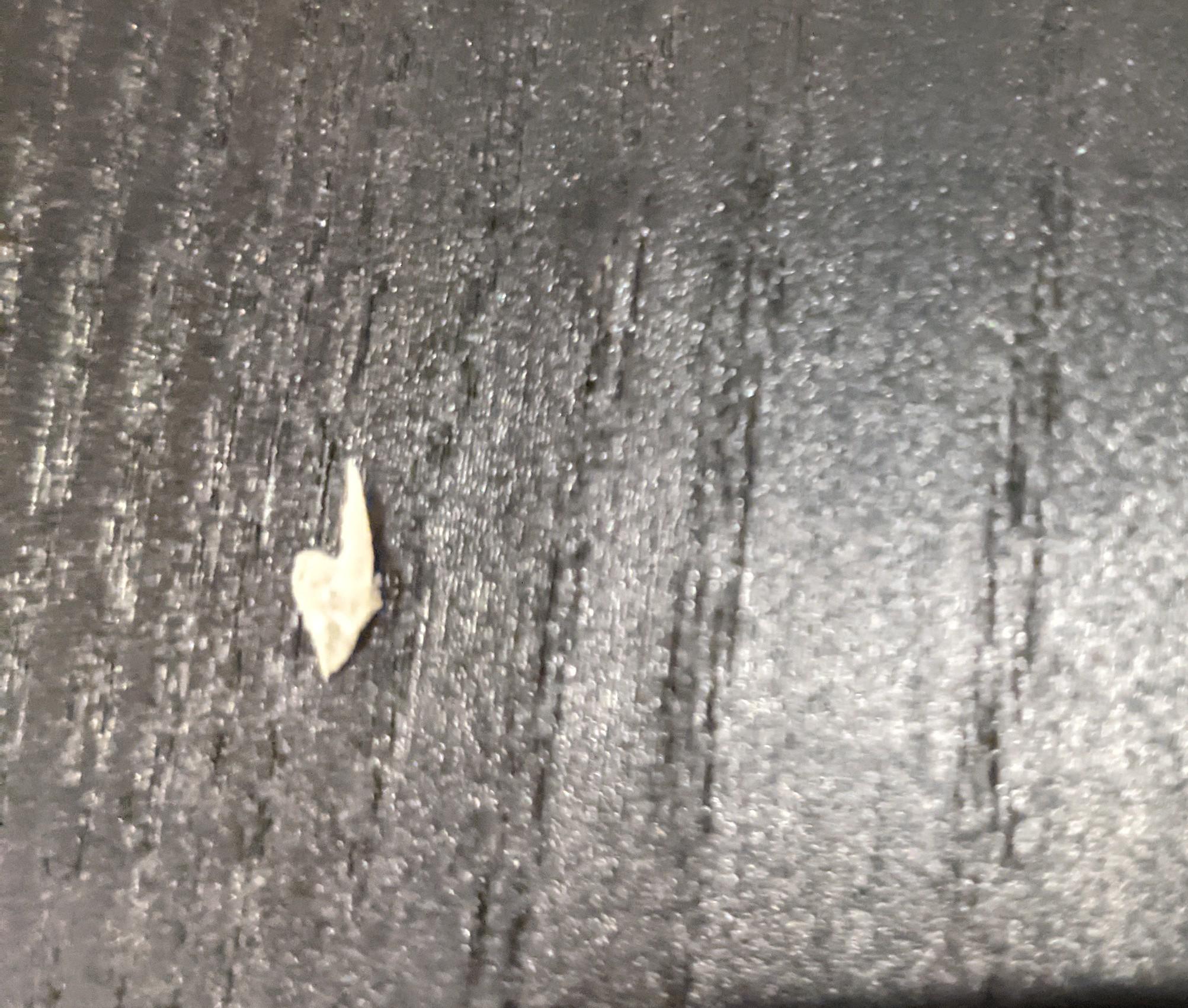 pulled-out-this-ingrown-toenail-from-last-night-not-a-pop-itself-but