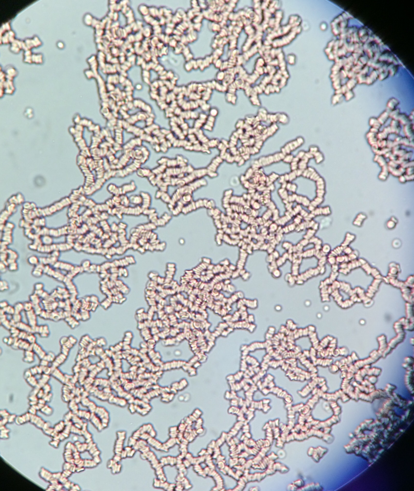 rouleaux-in-a-bloody-urine-sample-scrolller