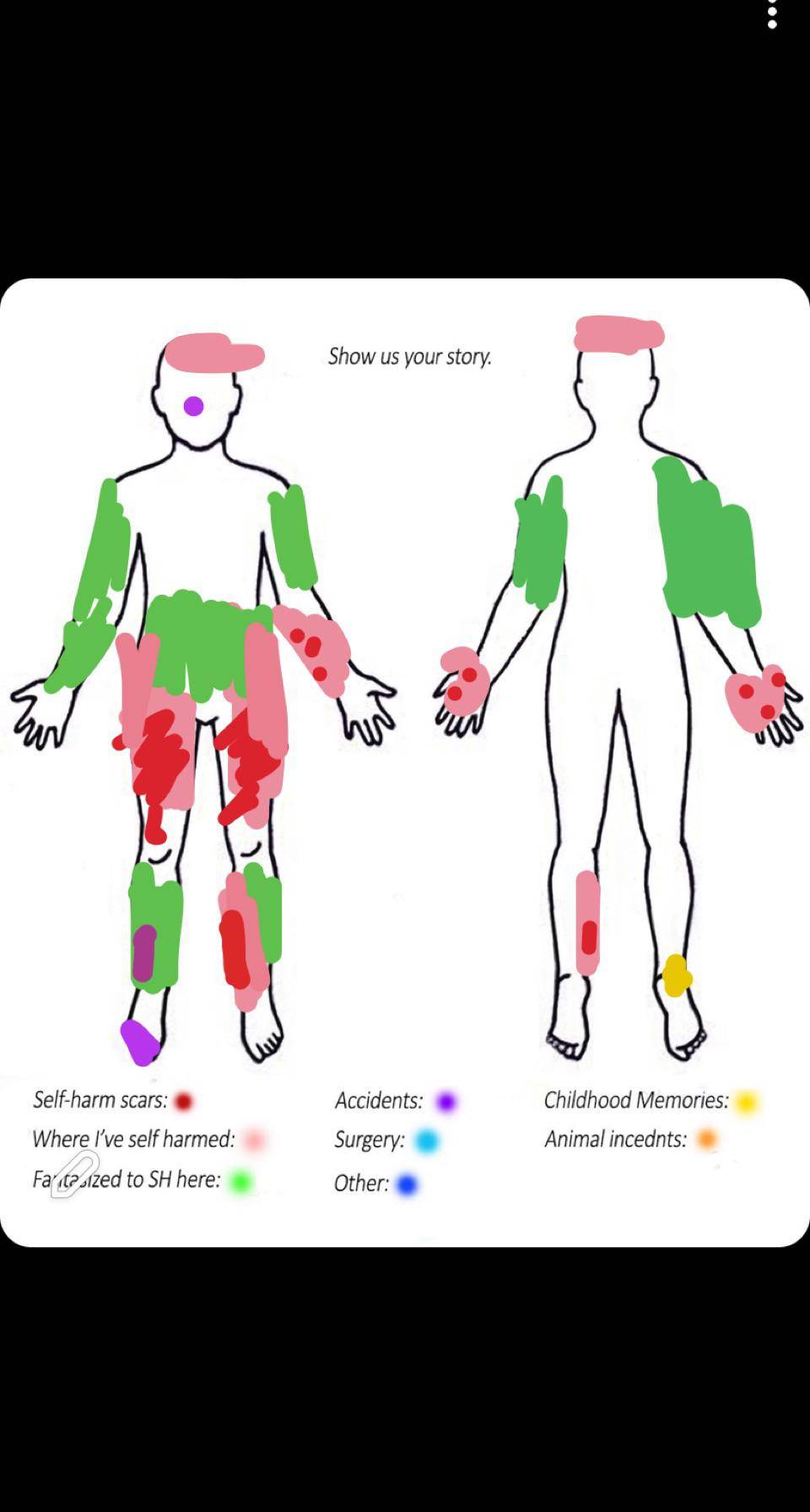 self harm chart Scrolller