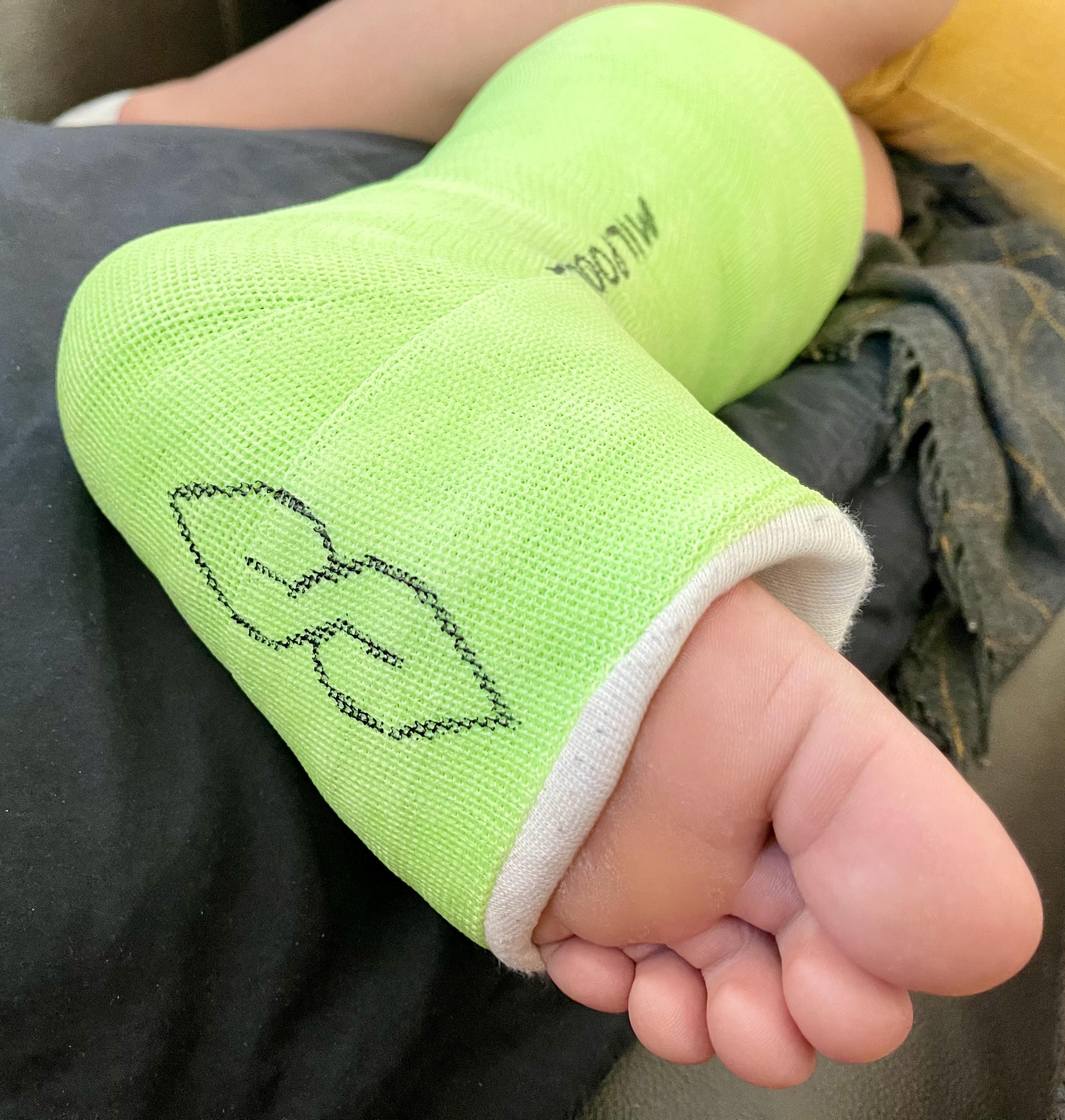 she-asked-me-to-draw-something-nice-on-her-cast-this-was-the-only