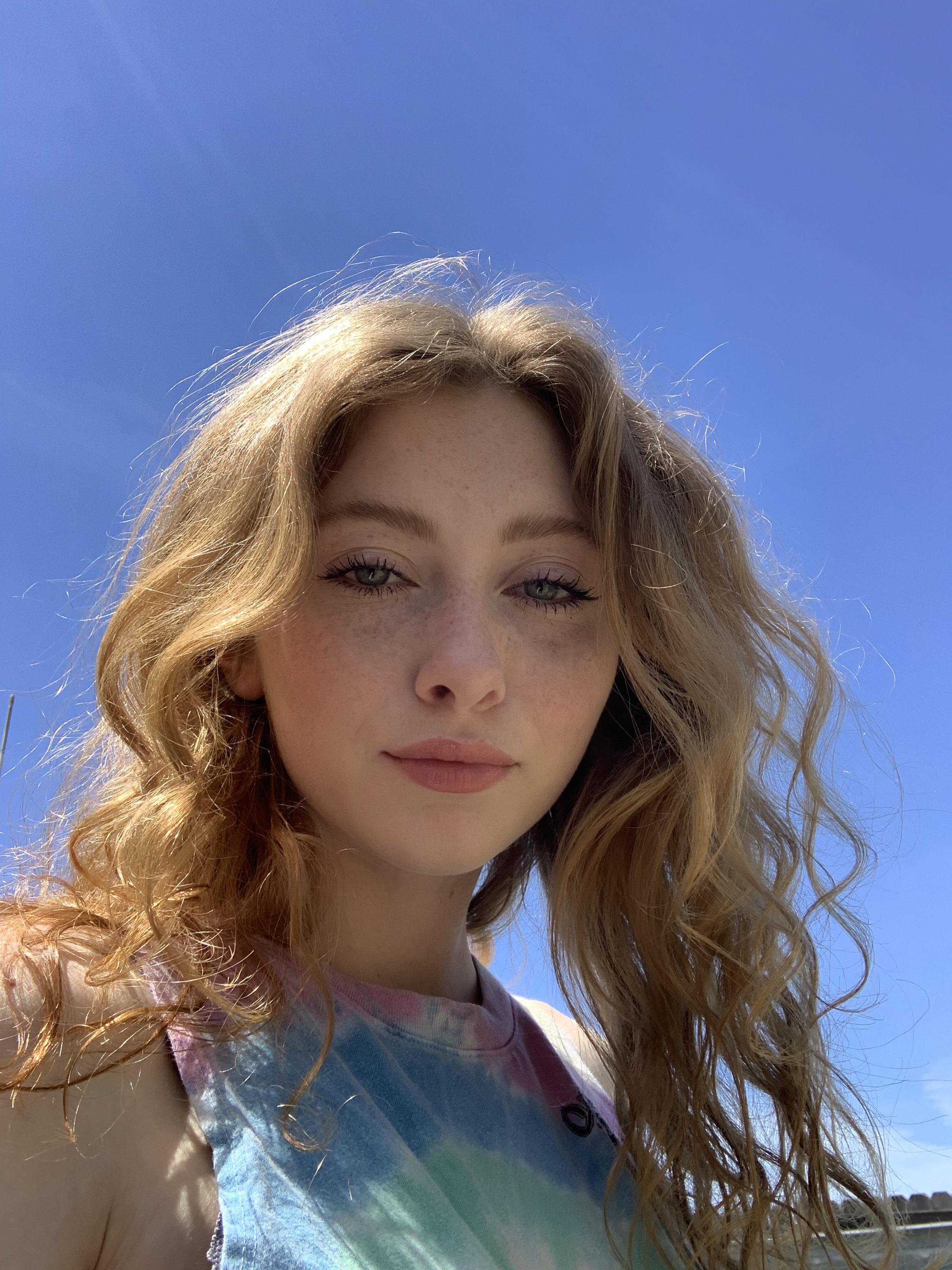 The sun really brings my freckles out, Anyone else lol ? Scrolller