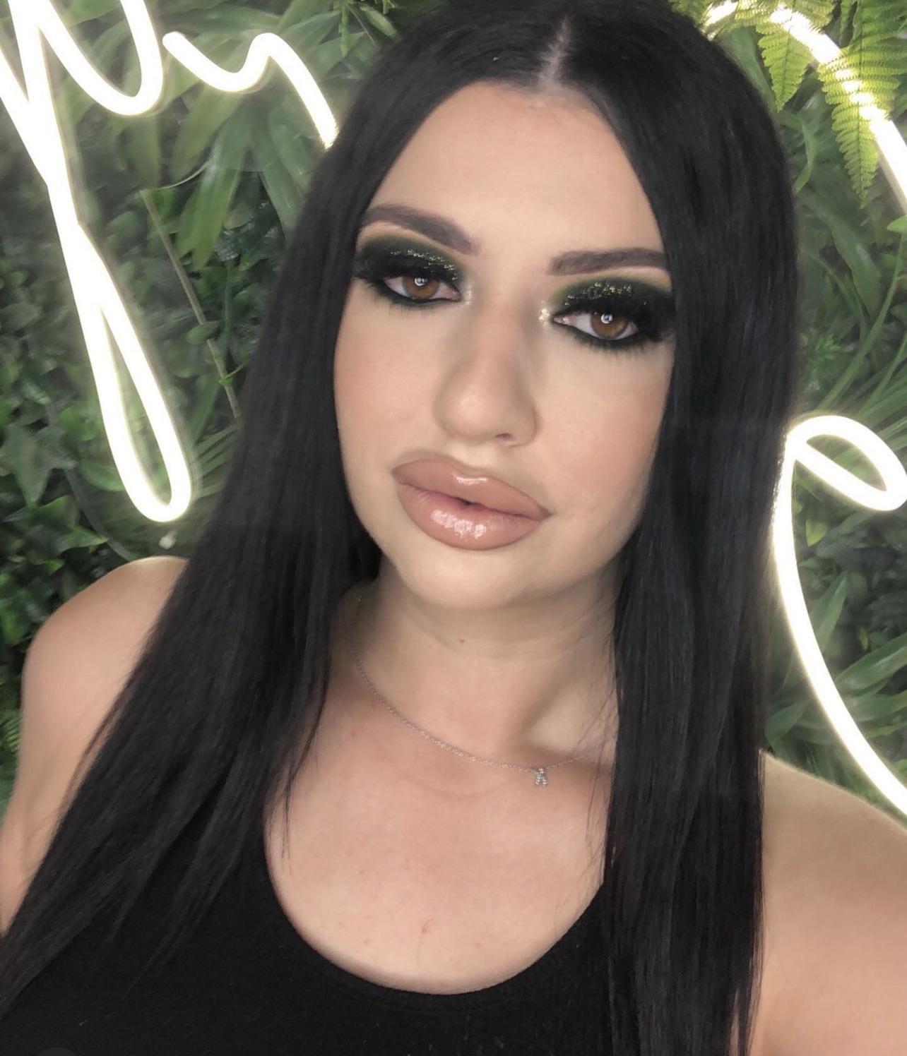 Time for more filler I think 💋 | Scrolller