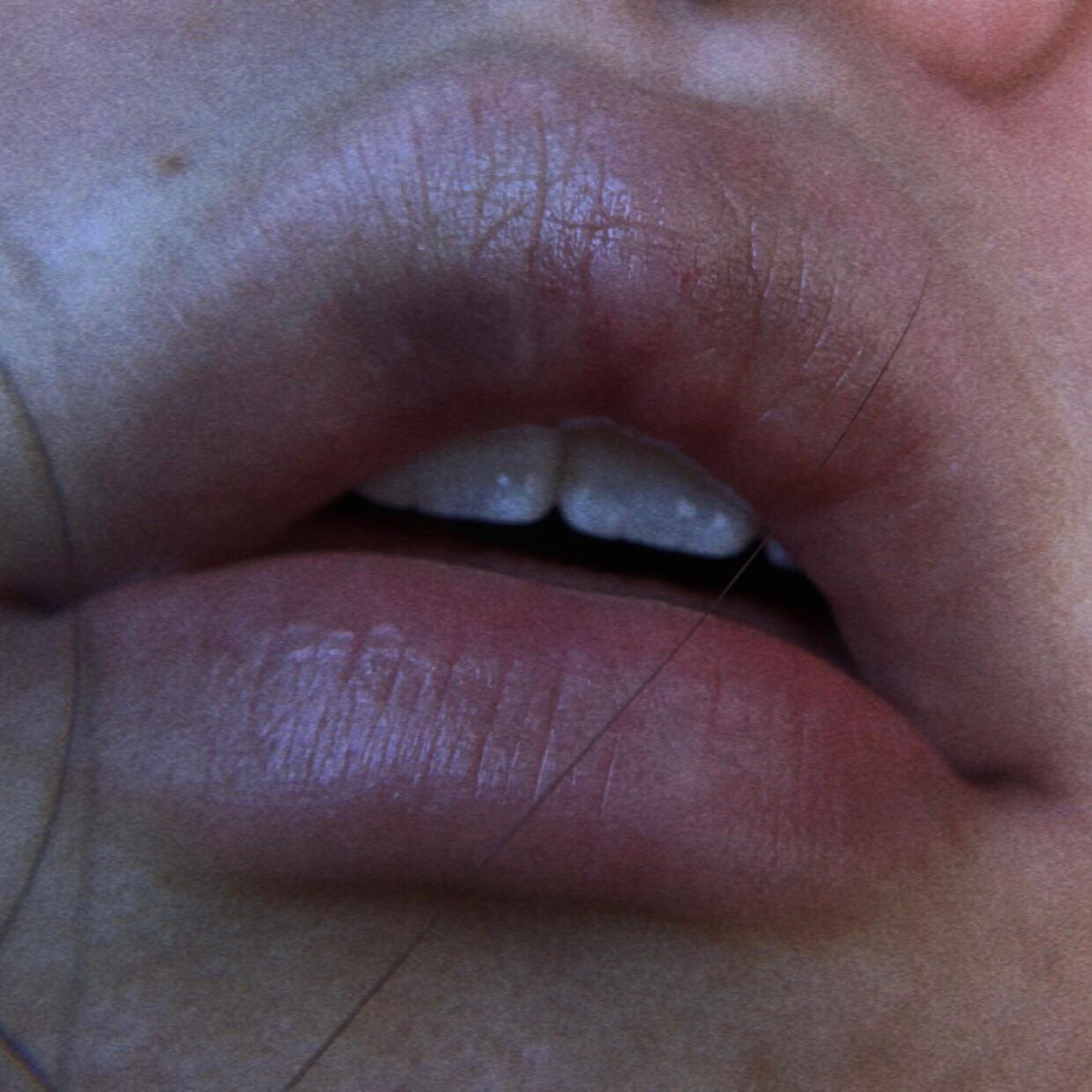 Took a picture of my bruised lip and the result was more aesthetically ...