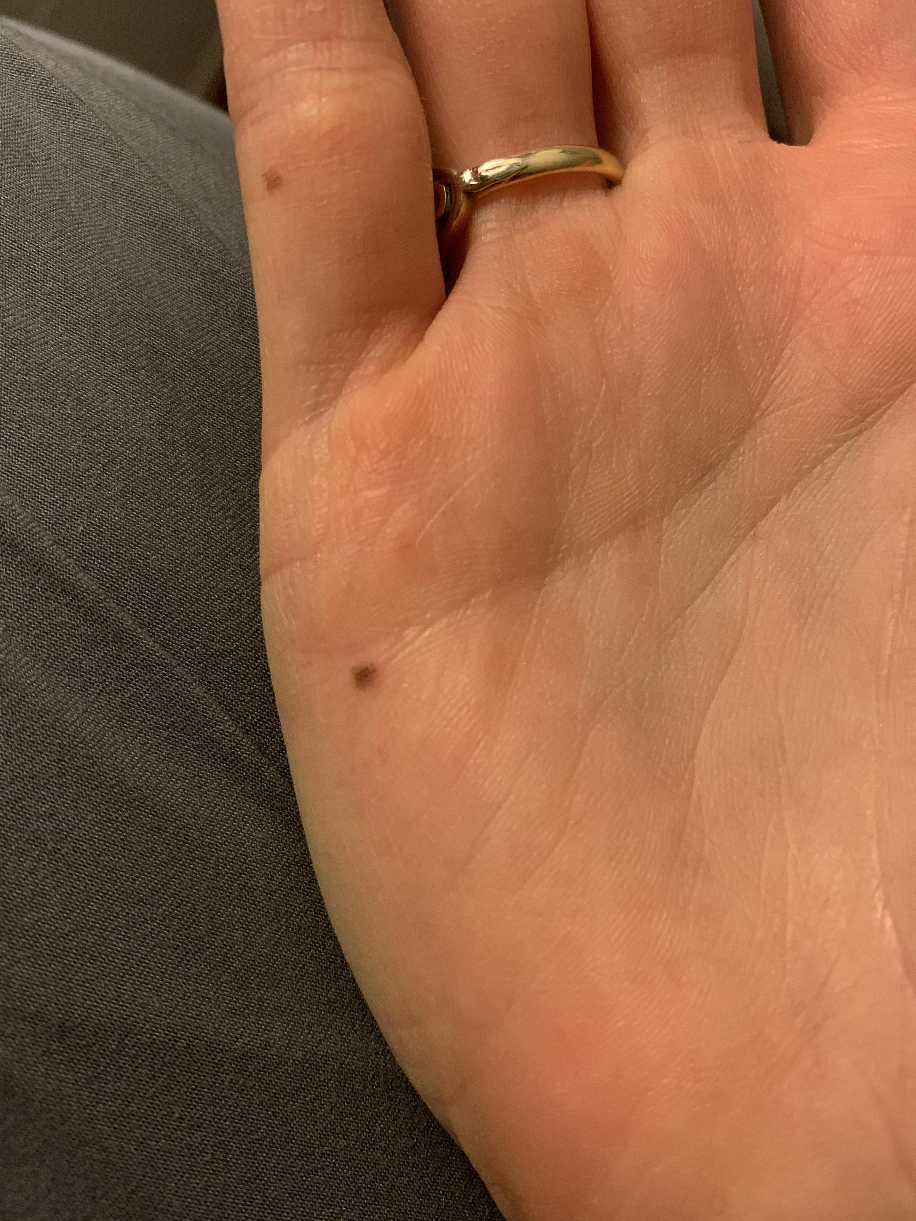 Two newer moles on hand Scrolller