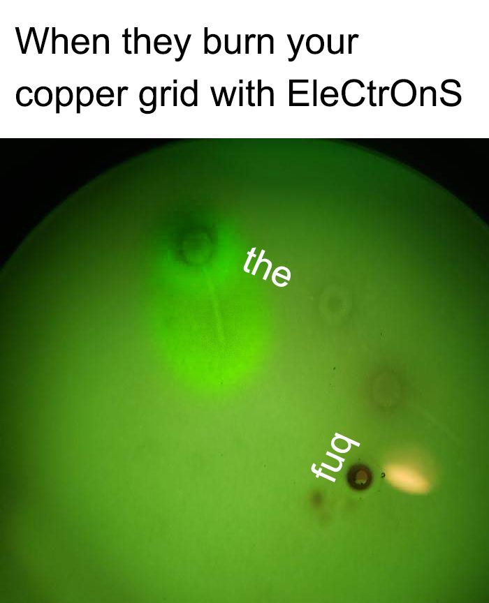 Under the Electron Microscope | Scrolller