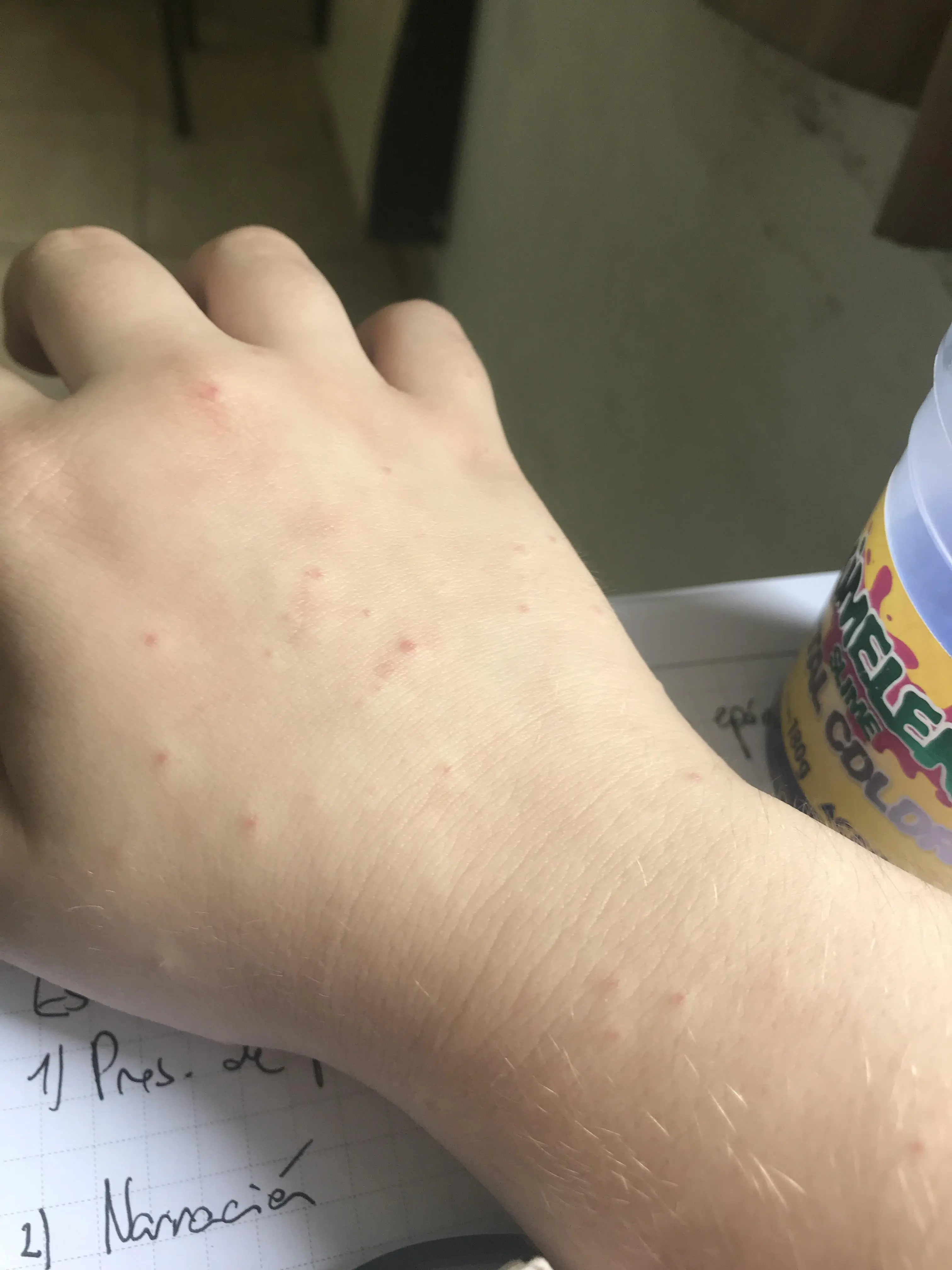 What are these red spots? they show up on my hands + arms from time to time and aren’t itchy