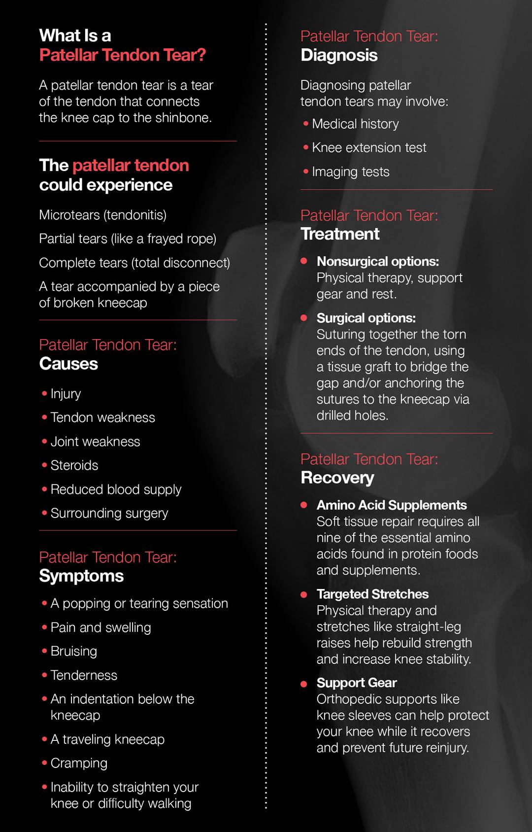 What is a Patellar Tendon Tear | Scrolller