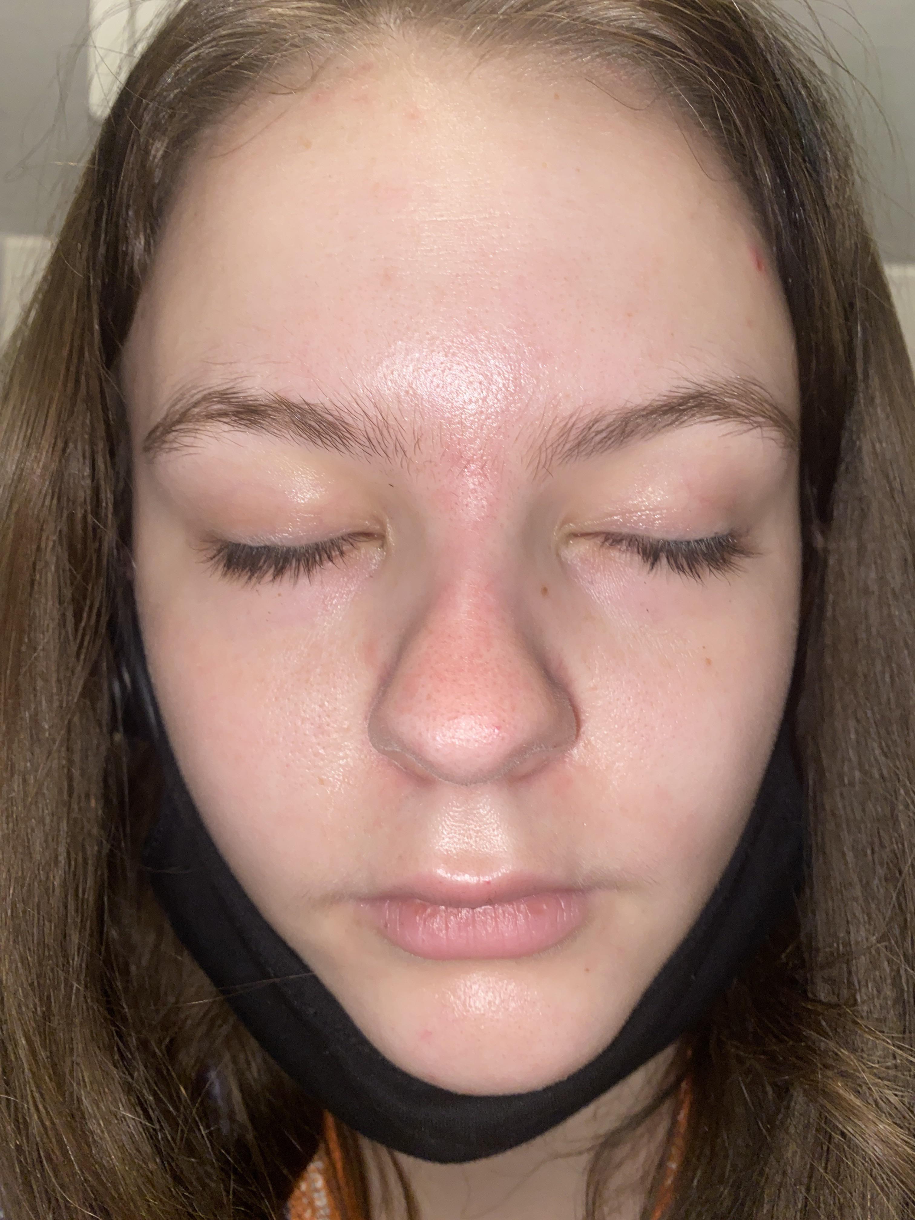 What is my nose shape pls help scrolller