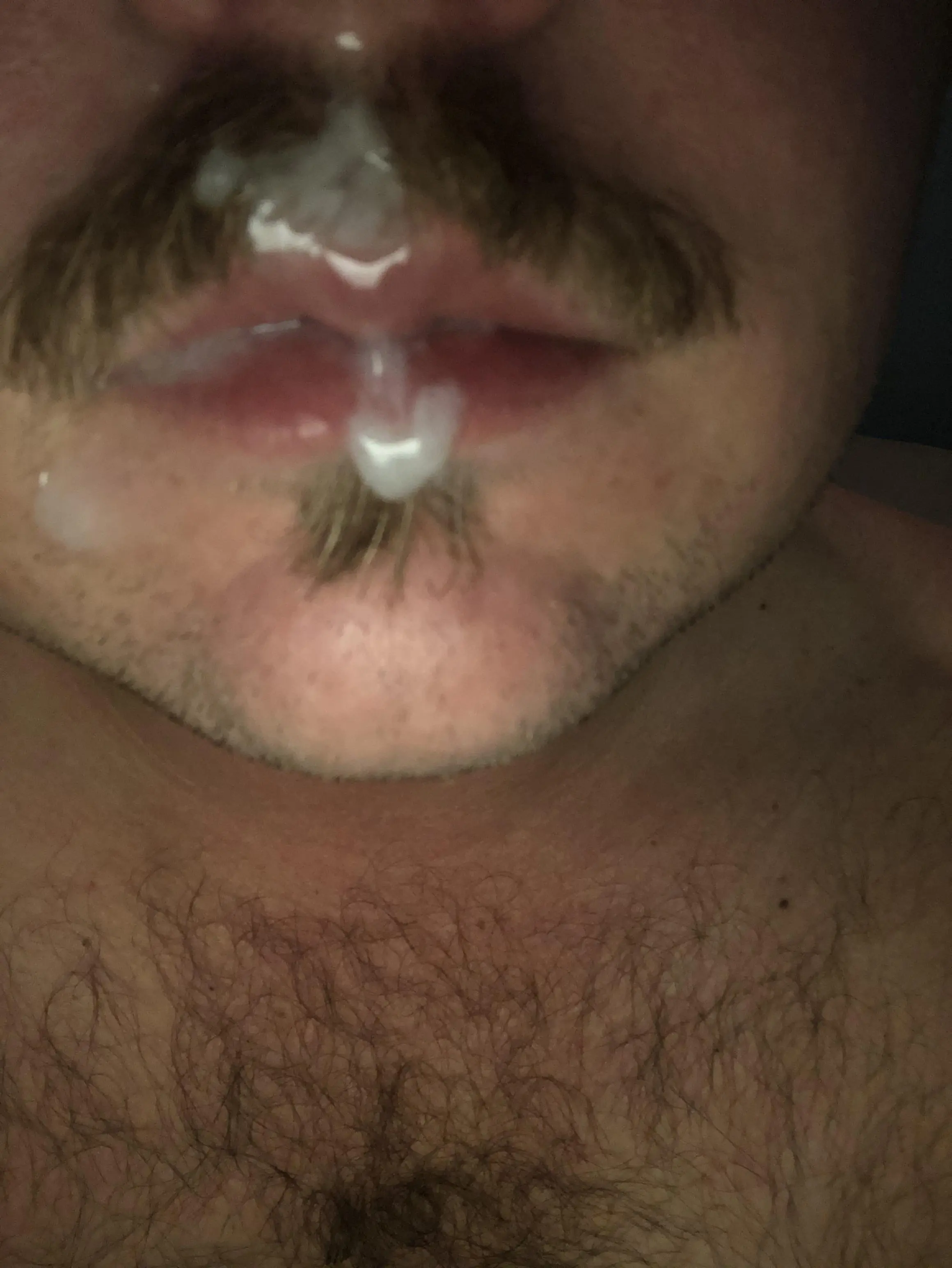 Who else loves self facials? (Oc)
