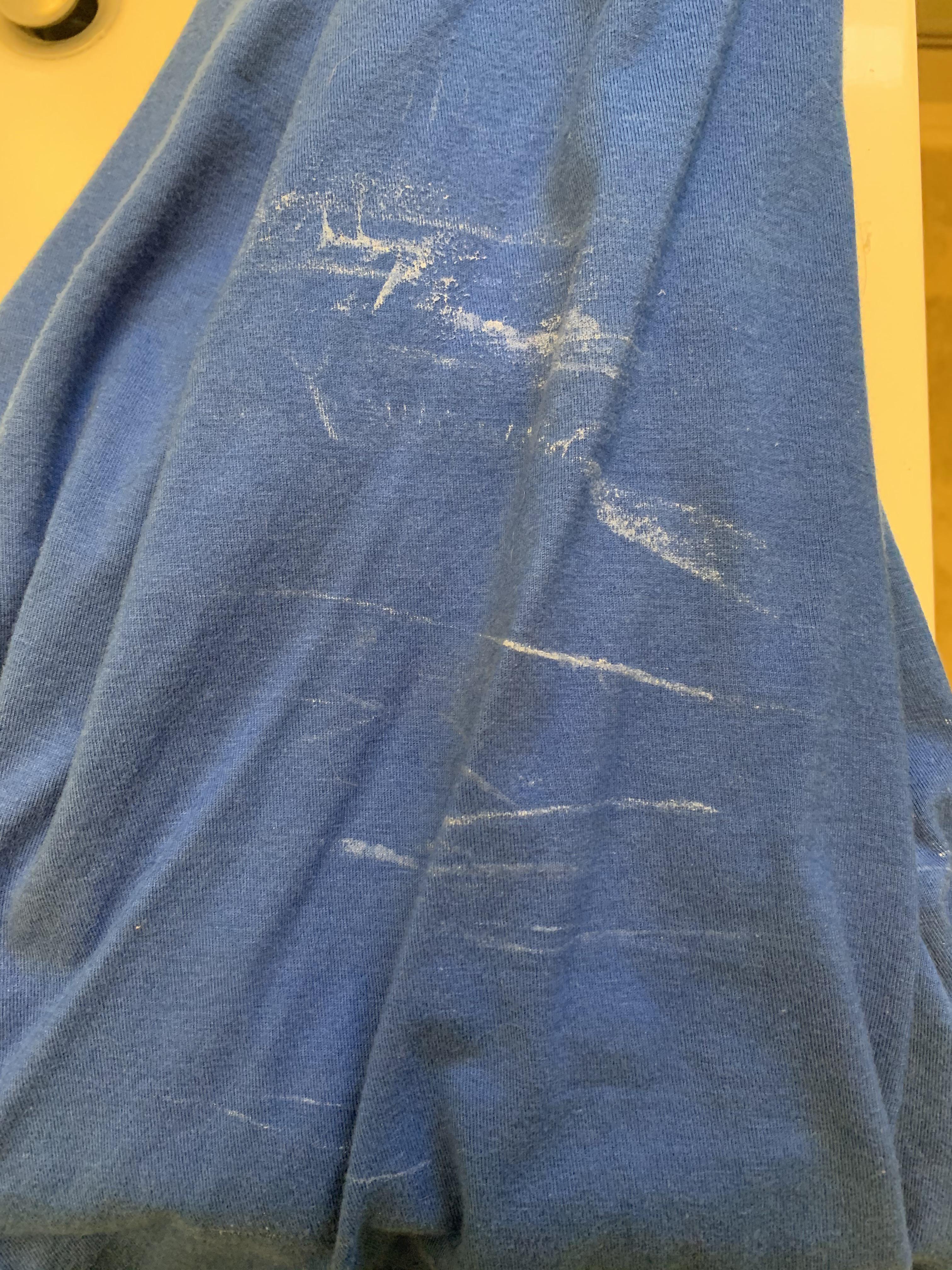 Why do some of my shirts have these marks on them? Any ways to avoid it ...