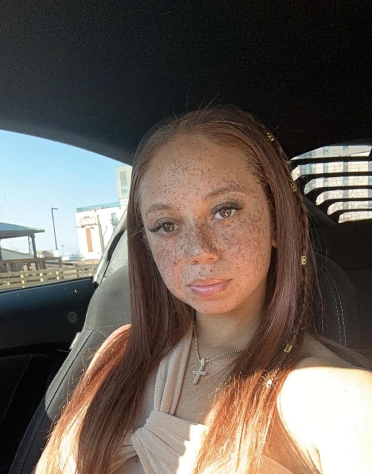 Are My Freckles Too Much Scrolller are-my-freckles-too-much-scrolller