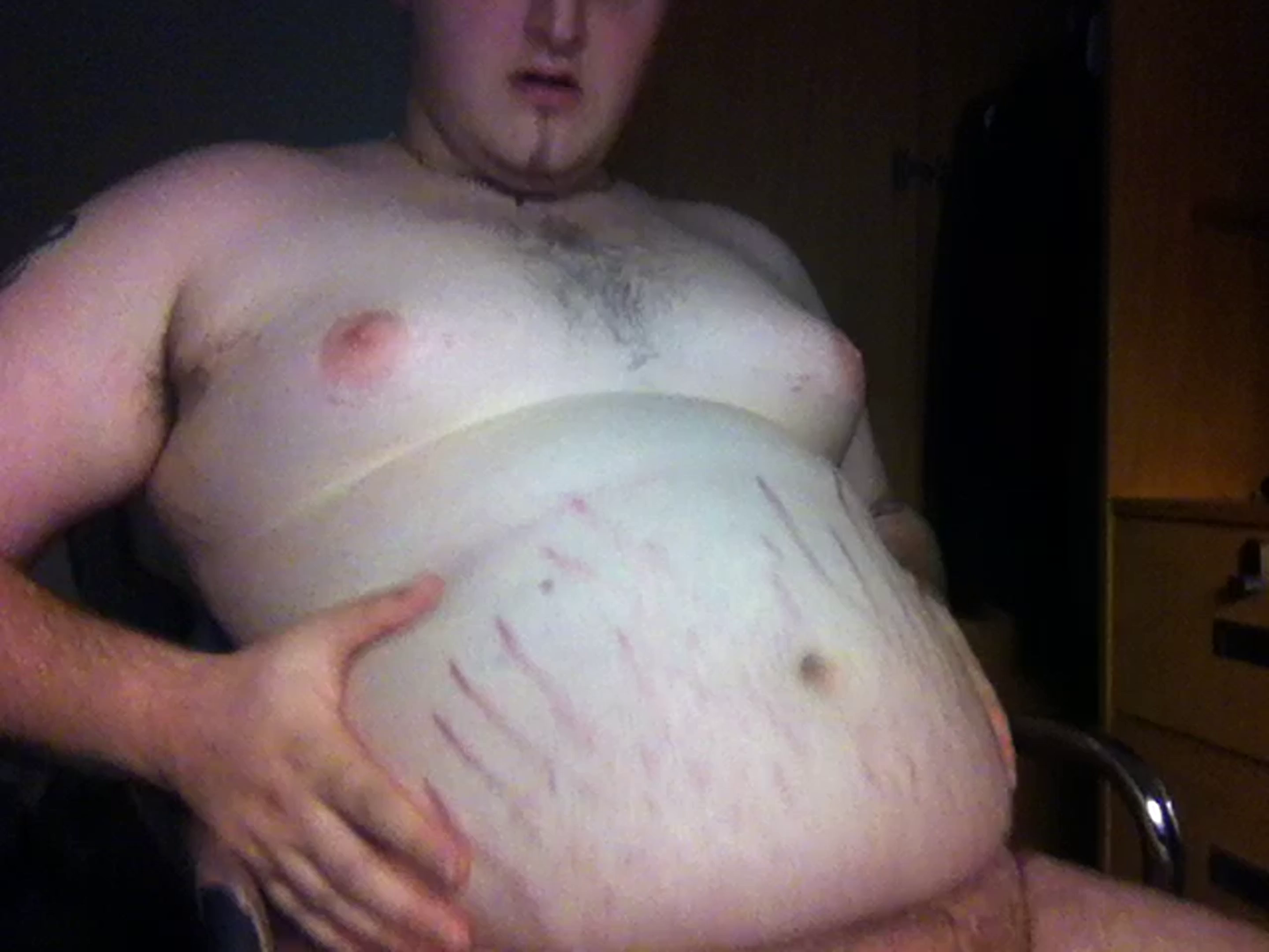 Stretchmarks