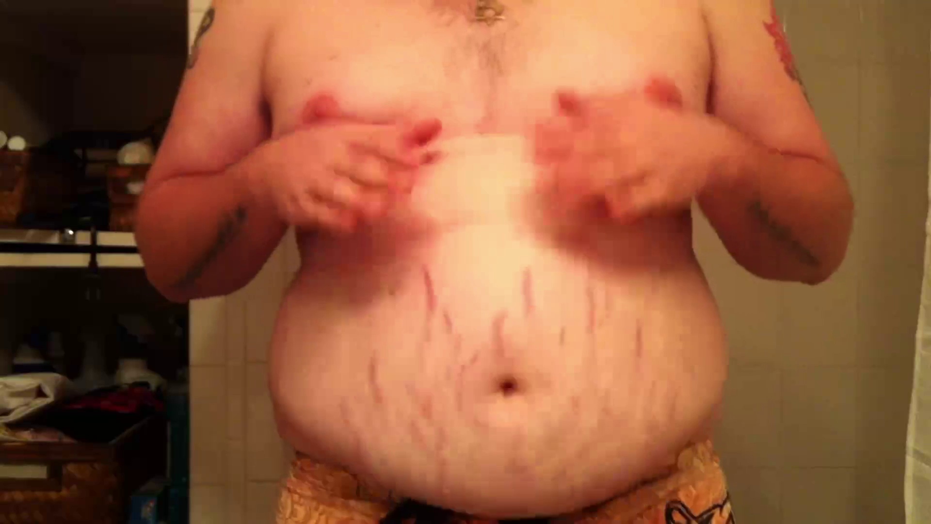 My stretch marks :)
