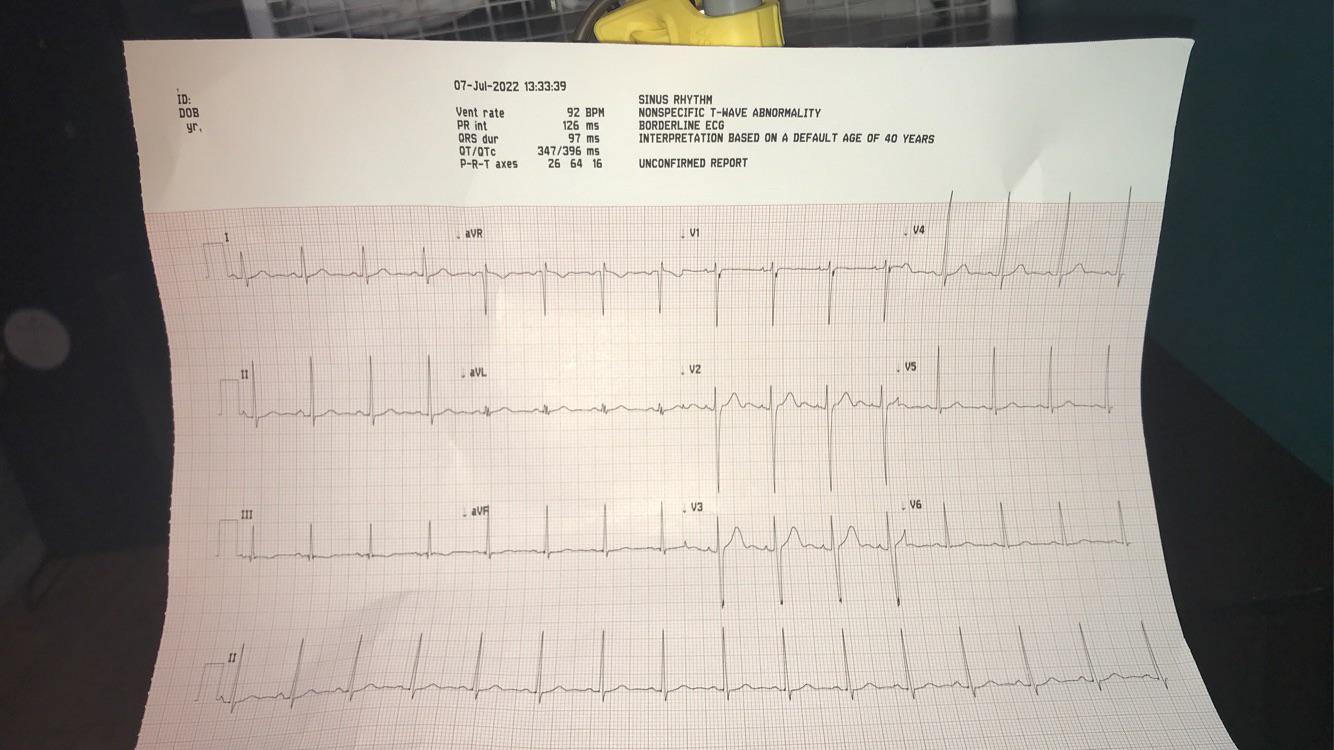 Nonspecific T Wave Abnormality 