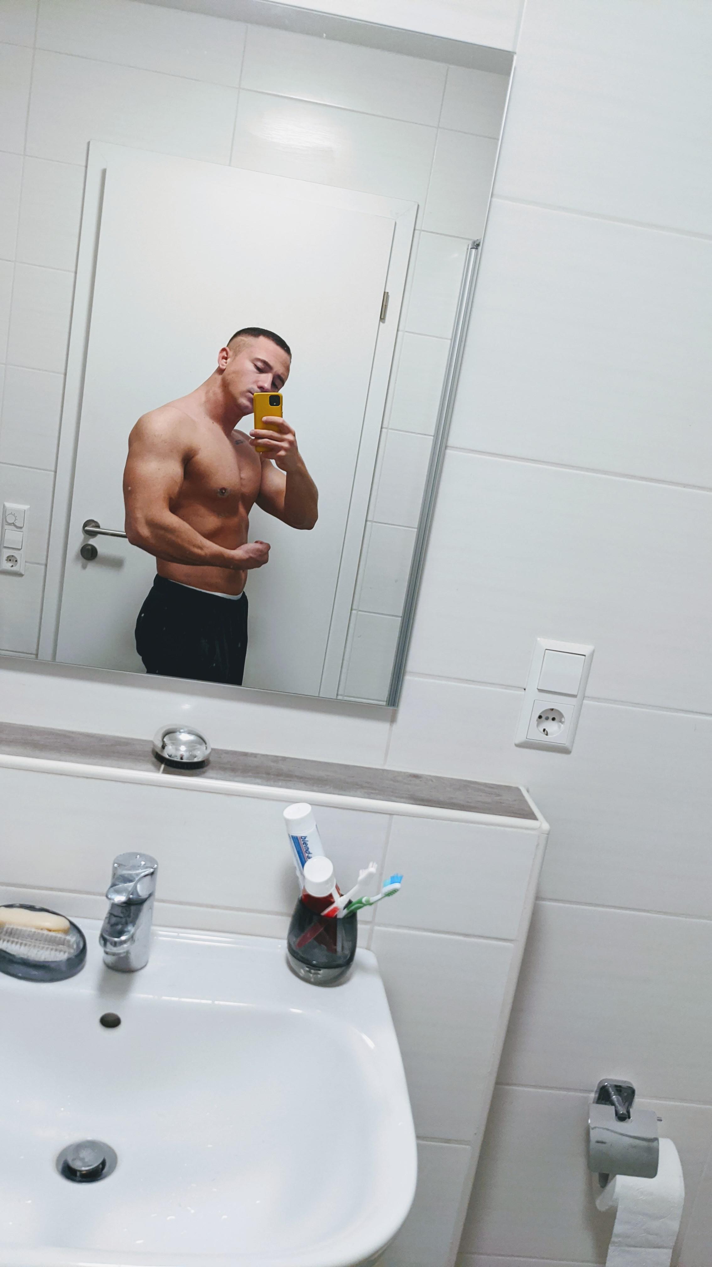 2 weeks after gland removal and lipo, lost 6 kgs