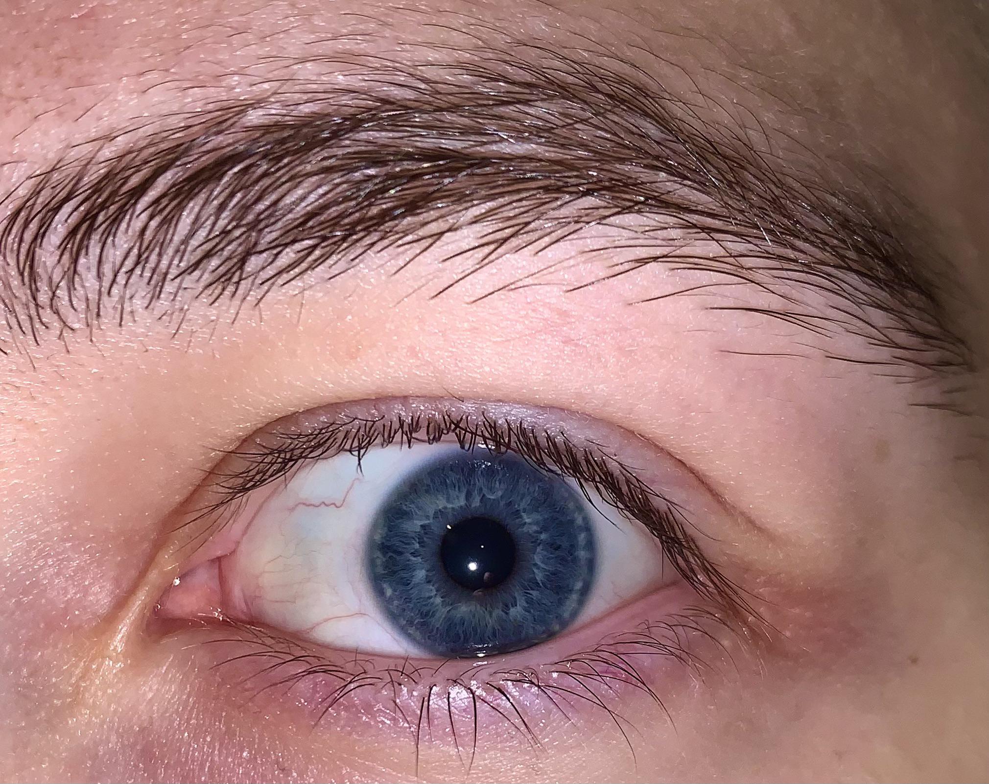 Central Heterochromia Scrolller