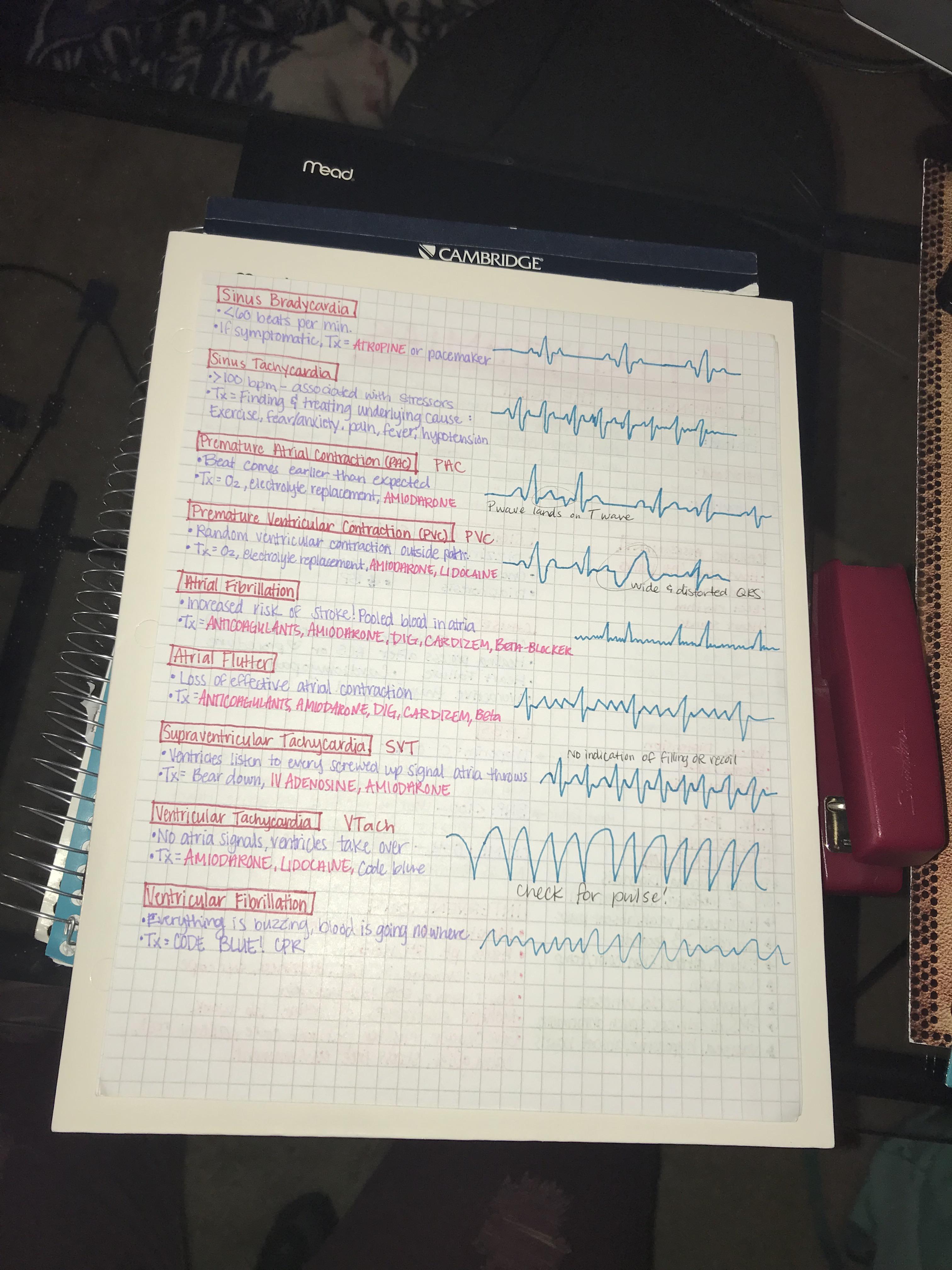 Dysrhythmias And Ecg Strips Scrolller