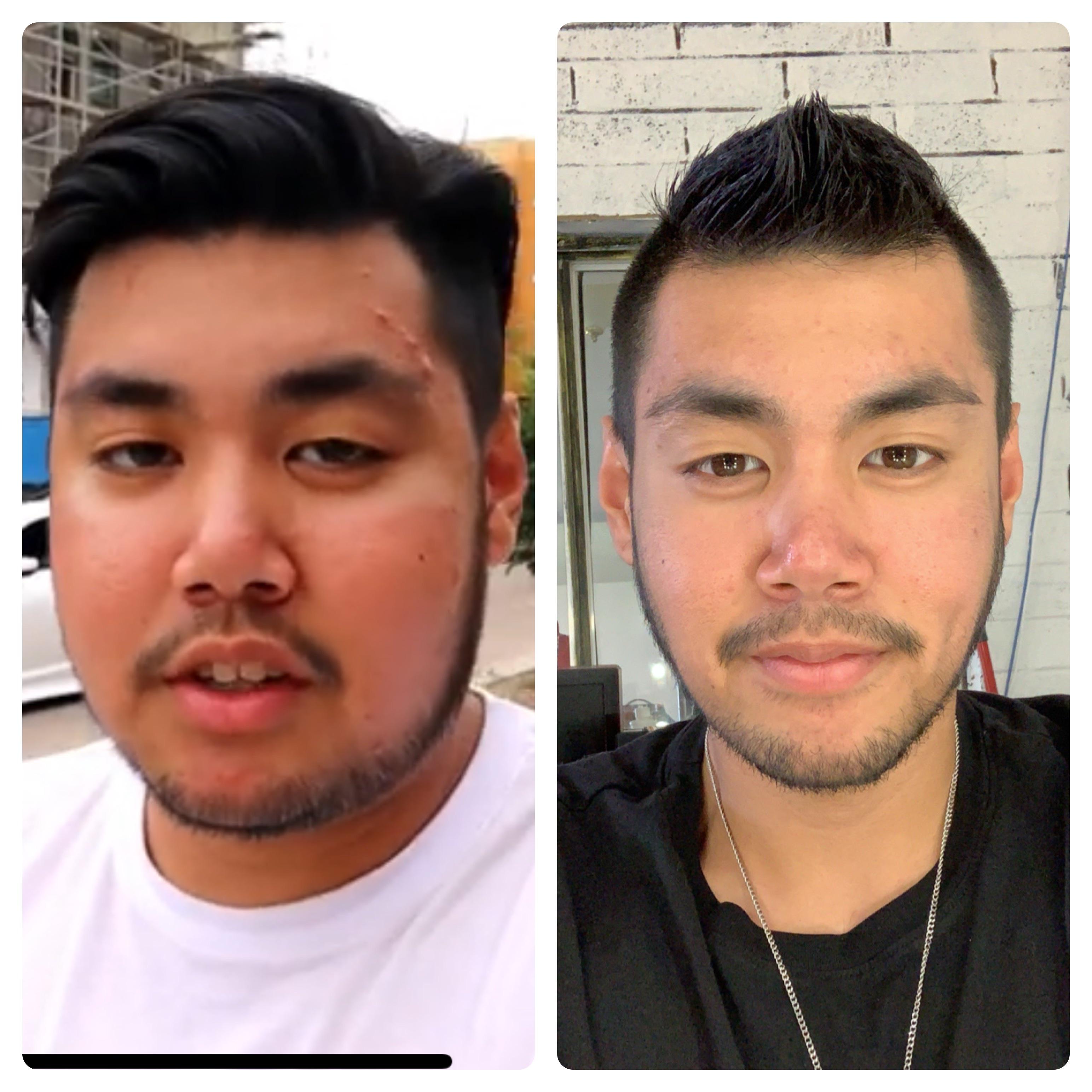 Face gains before and after losing 90+ pounds. 260LB-> 170LB | Scrolller