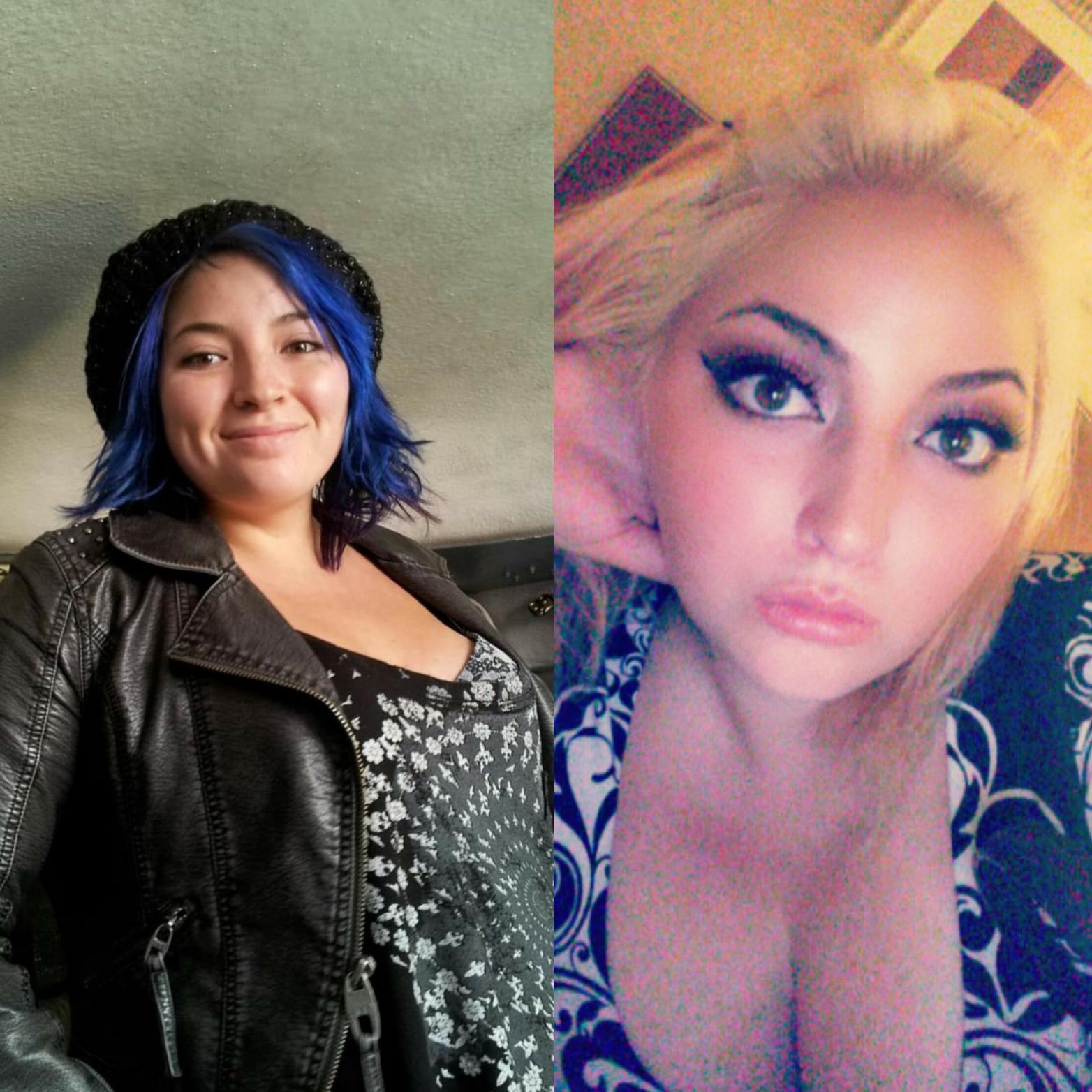 Omg! Sami Sheen'S Breast Augmentation Recovery! - ypicy5o