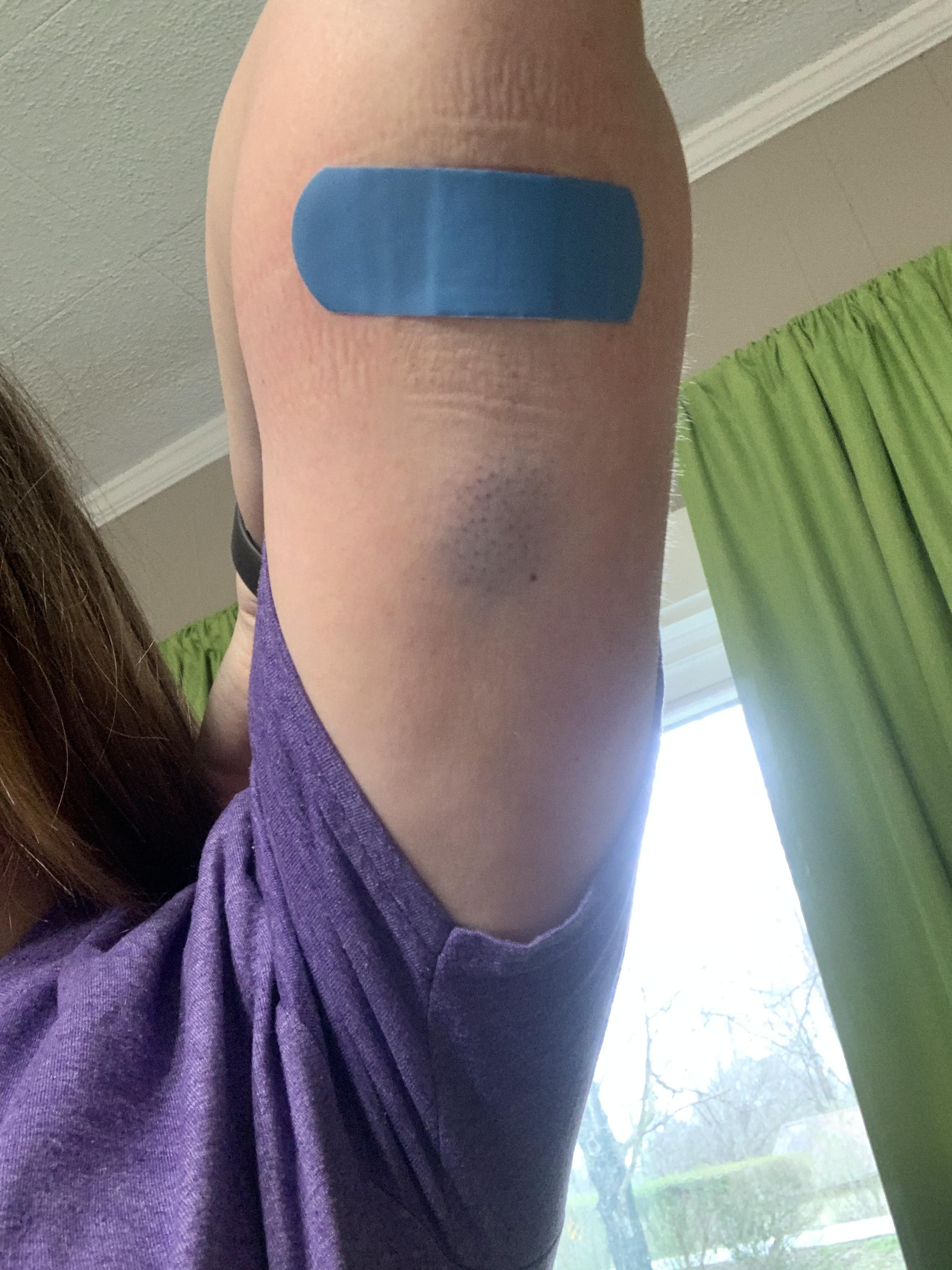 Nexplanon Placed On back of arm Scrolller