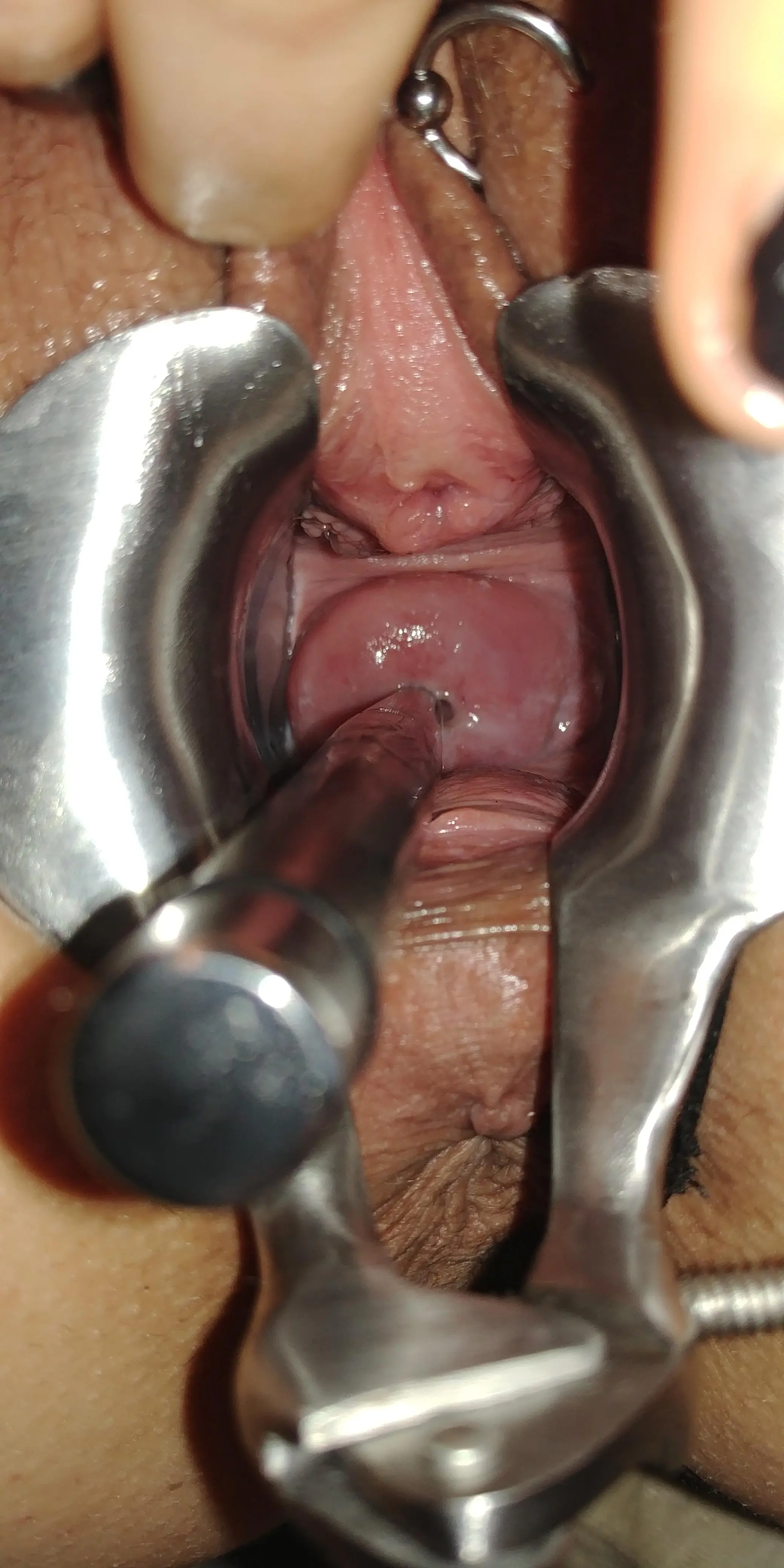 Stuffing the GFs cervix..