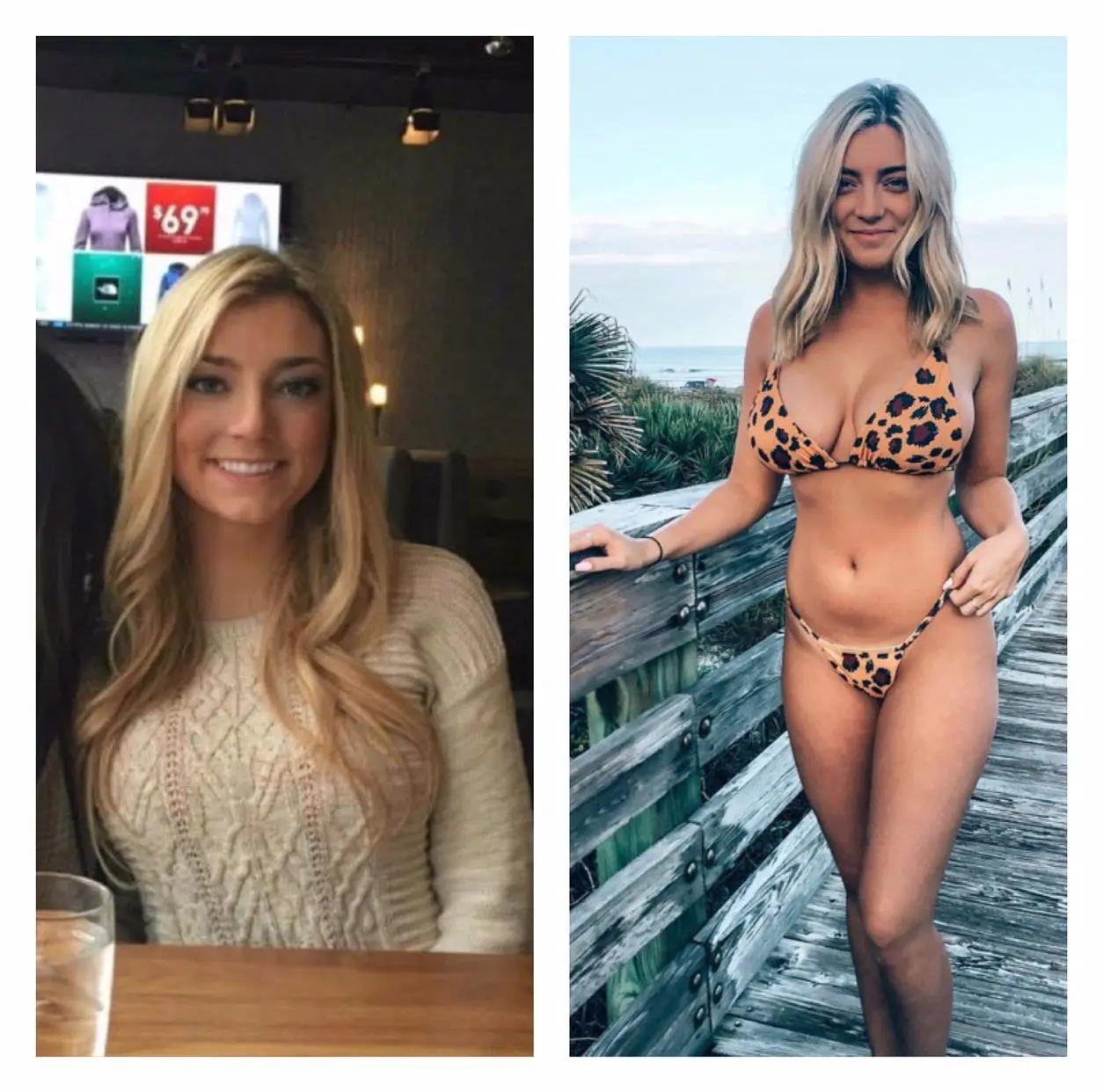 The breast kind of progression