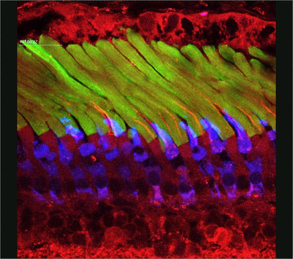 The Rods Detect These are rods and cones, photoreceptor cells in the eye which detect ...