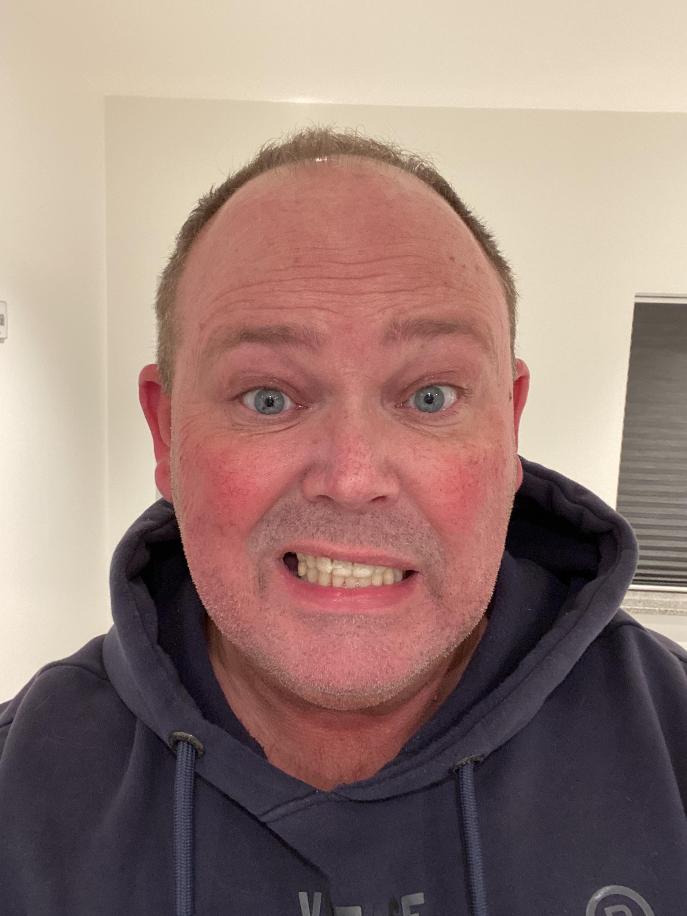 This Is What A Face Looks Like After Walking 3 Miles In 14 Degree Windy this-is-what-a-face-looks-like-after-walking-3-miles-in-14-degree-windy