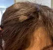 Burnt hair turned yellow??