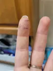 MedicalGore