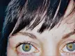 Hi... is heterochromia common in anyone else's family? My mom, my daughter, and I have the same color eyes...my sister also has central, but hers are a different color... several of my cousins have either central or sectoral...my grandfather had sectoral, and his father had complete heterochromia...