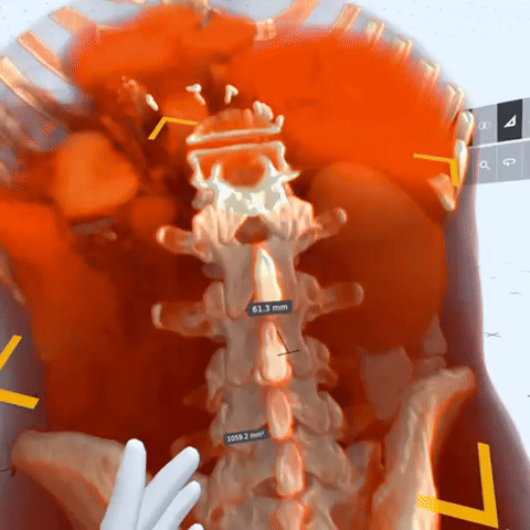 Could VR become standard for pre-surgical anatomy review?