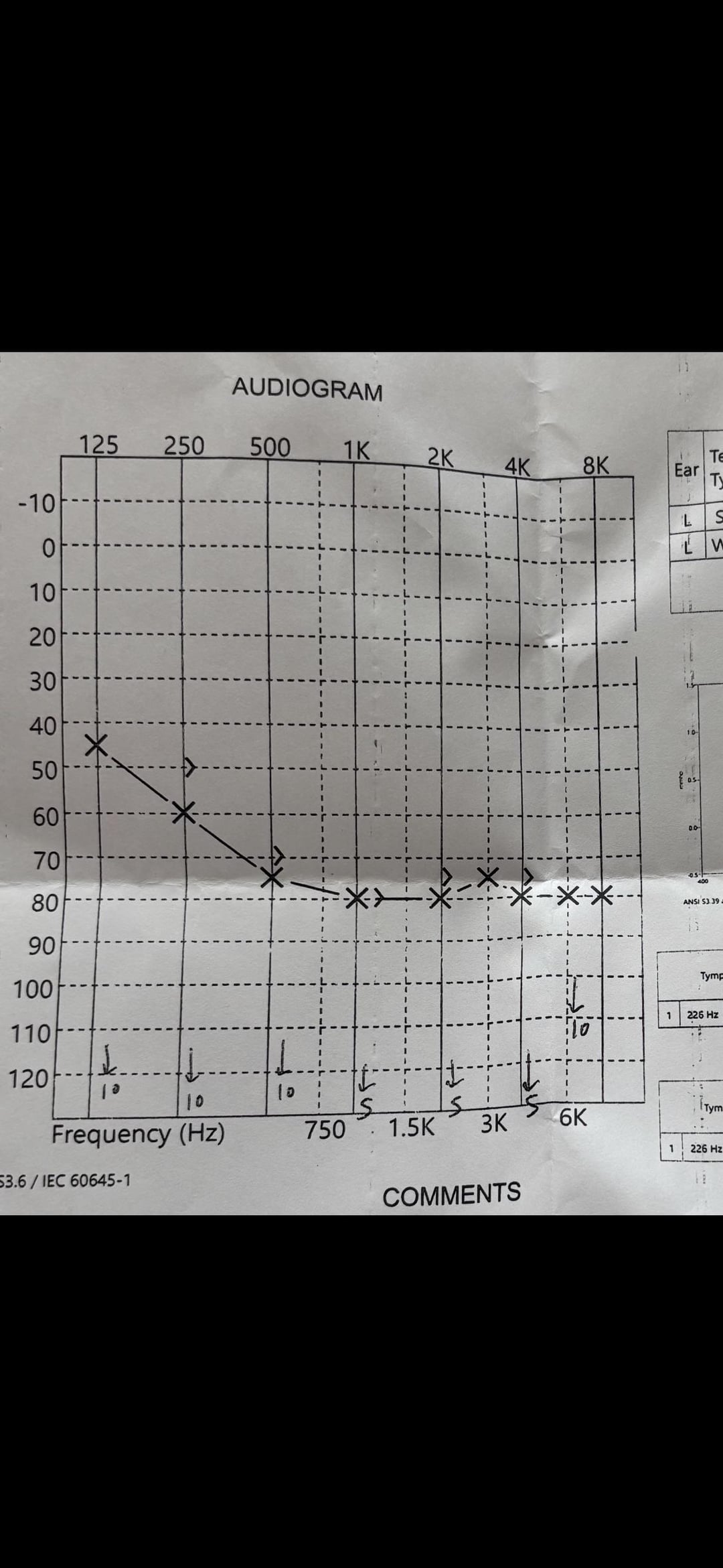 A close-up of a printed audiogram chart showing hearing test results across various frequencies.