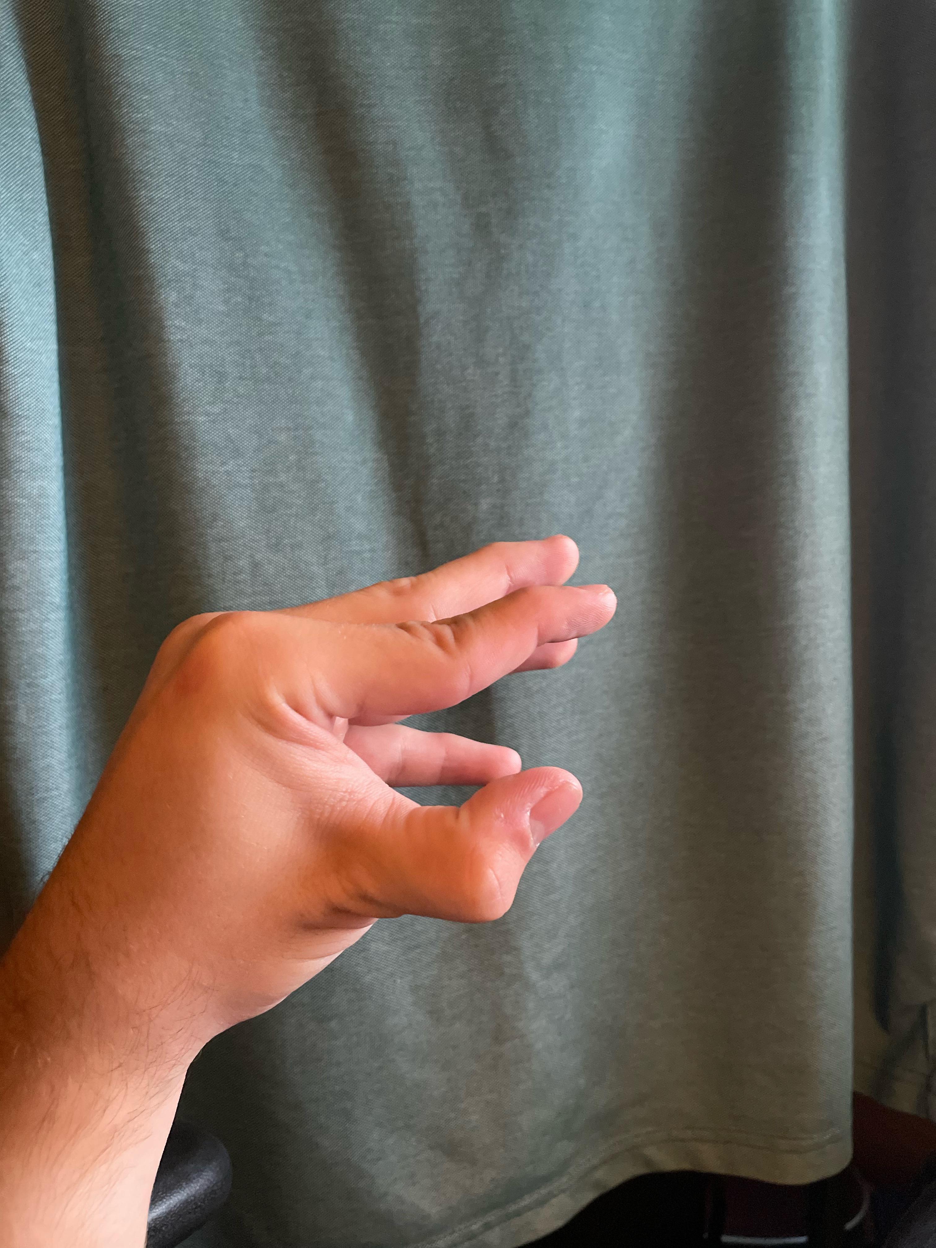 I guess we’re posting weird hand stuff here now.