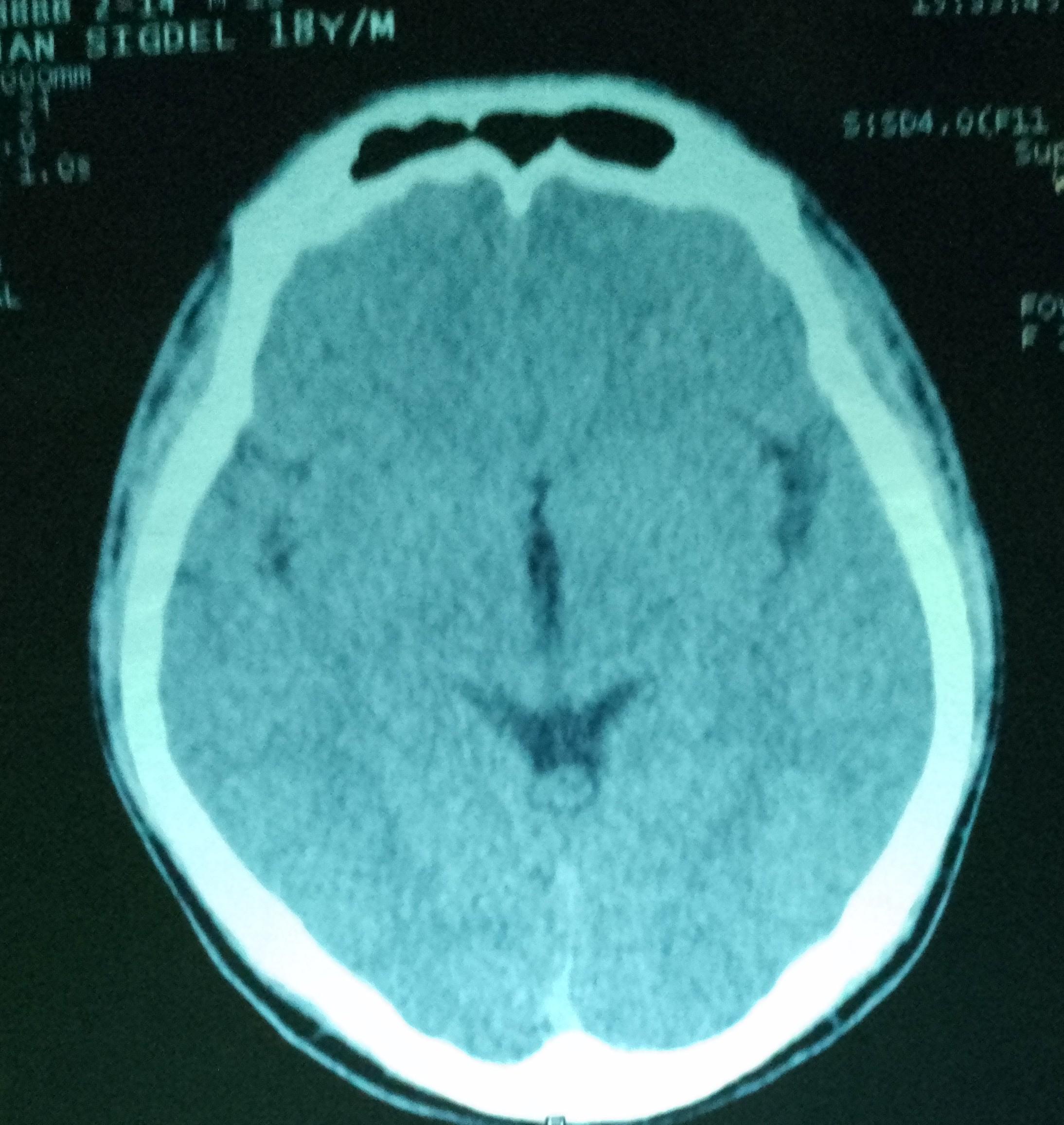 CT scan | Scrolller