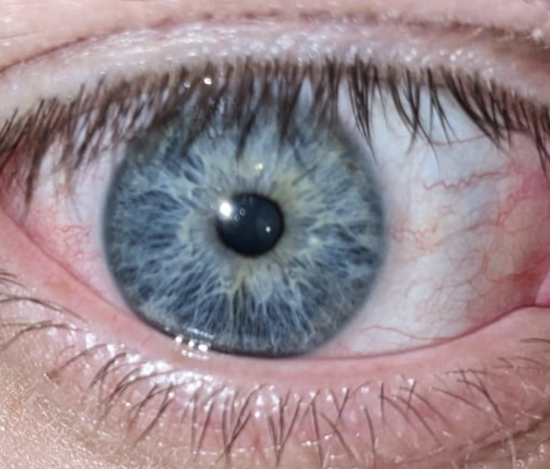 I've always said I have blue eyes, but sometimes they look like a deeper, blue, or even green based on what I'm wearing. What causes that phenomenon?