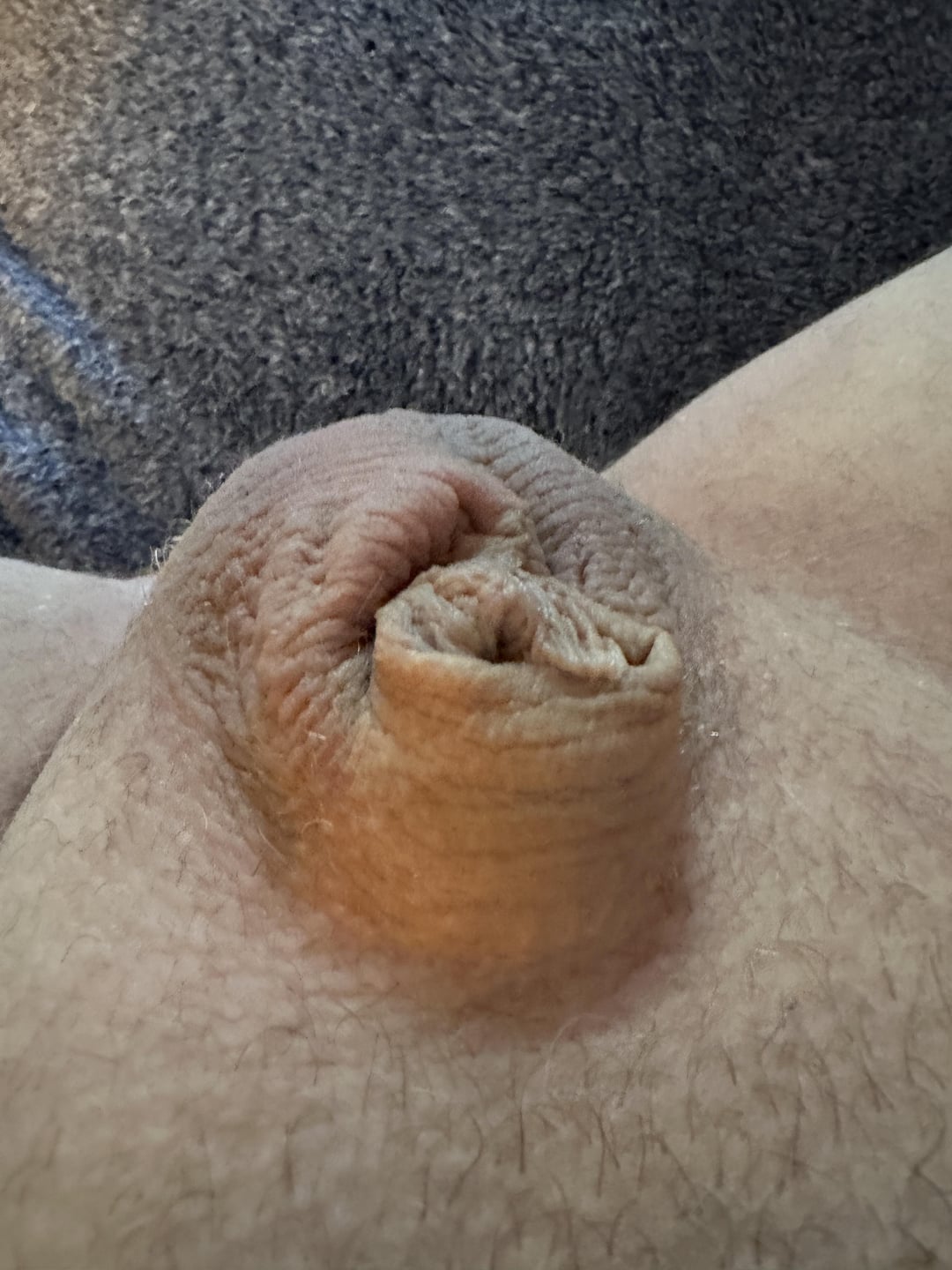 MicroPenis