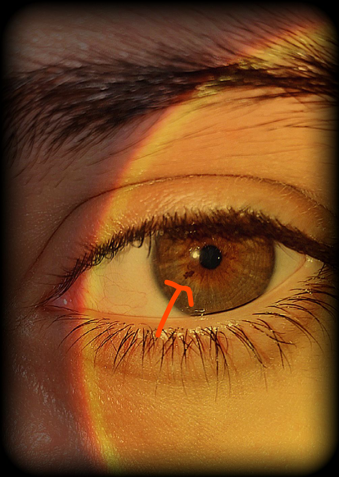 Guys i have heterochromia eyes. One of my eye is brown and the other one is green. But in my green eye there's something inside. Whats that called? I want to know.