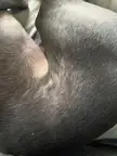 Greyhound dandruff